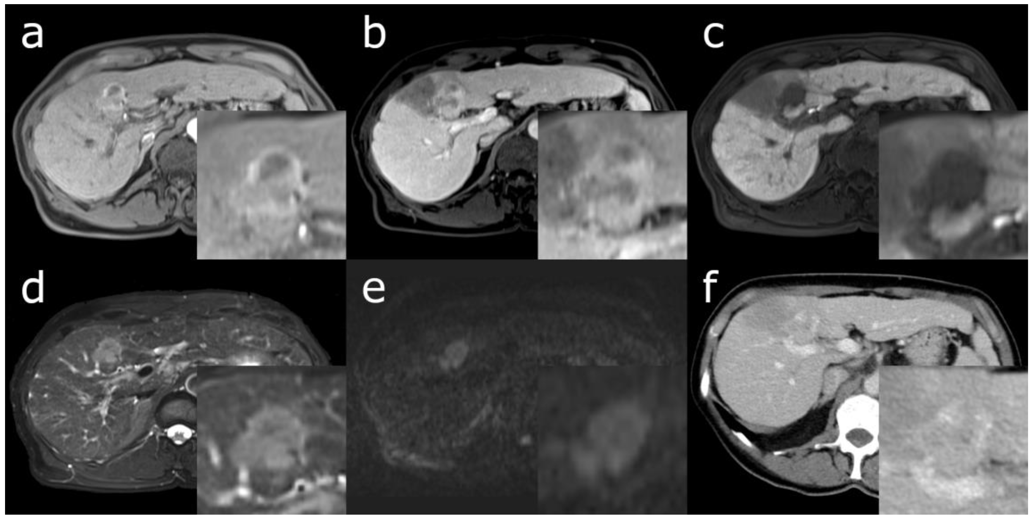 Cancers 15 00301 g001 Cancers 15 00301 g001