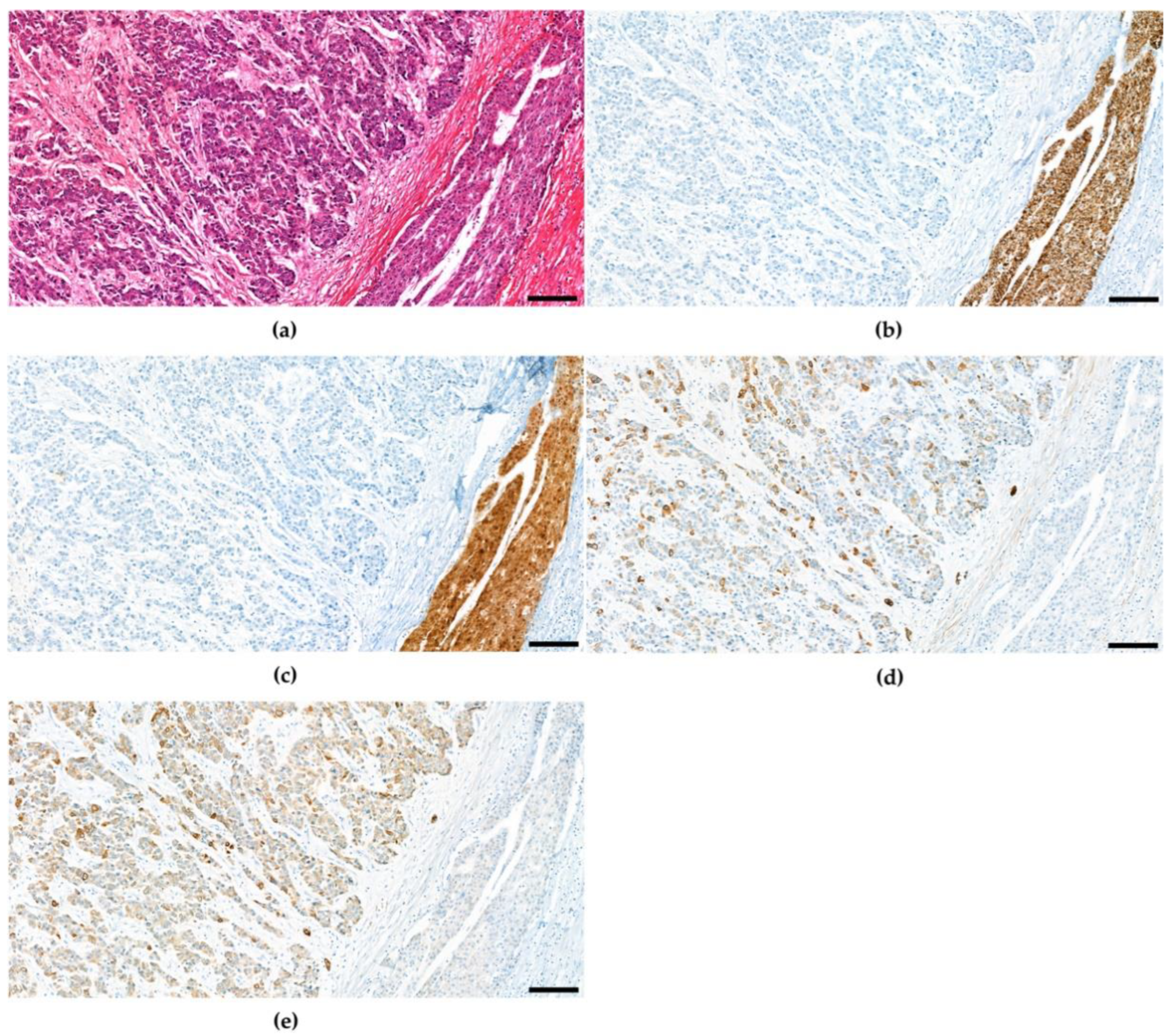 Cancers 15 00301 g004 Cancers 15 00301 g004