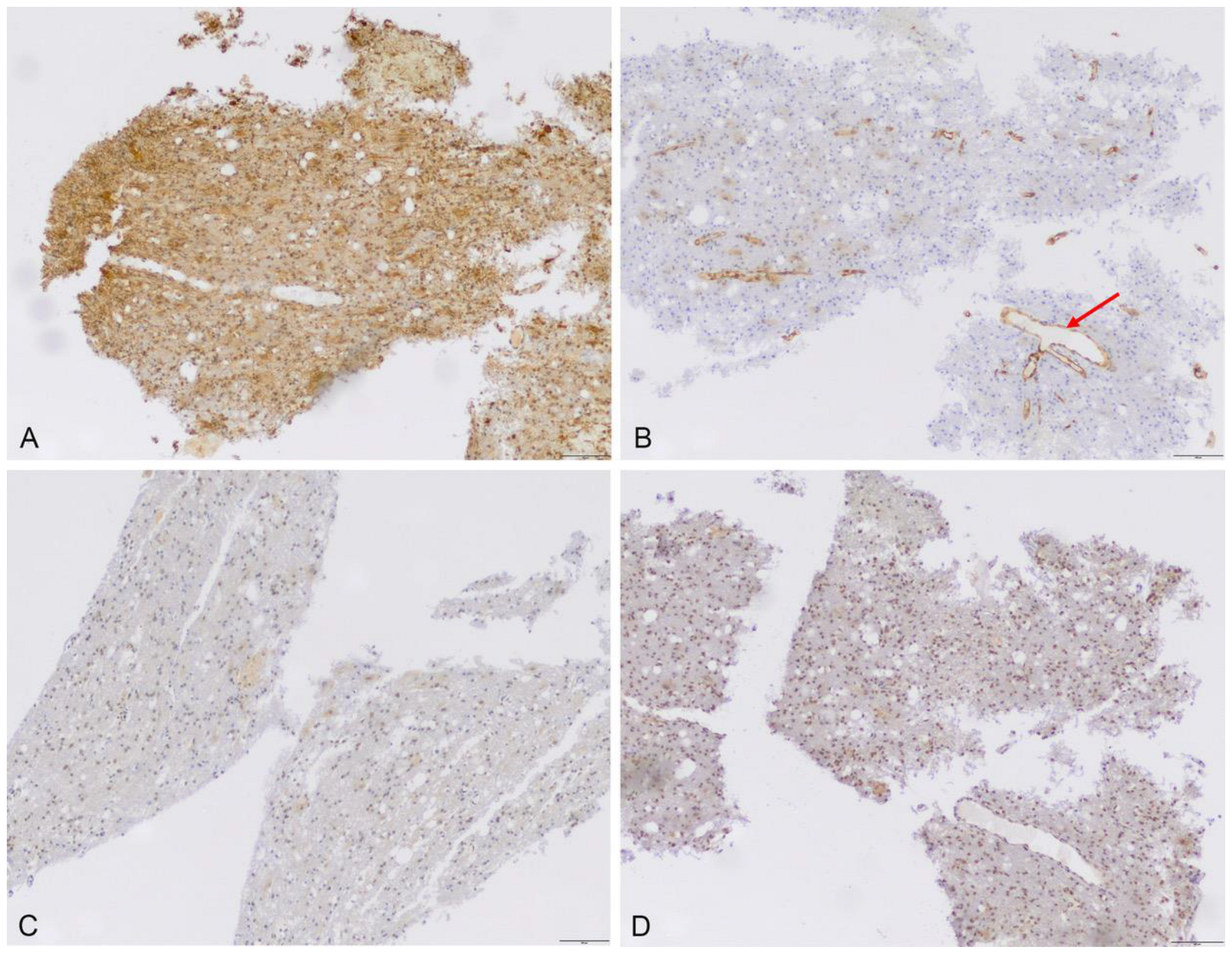 Cancers 15 00304 g003 Cancers 15 00304 g003