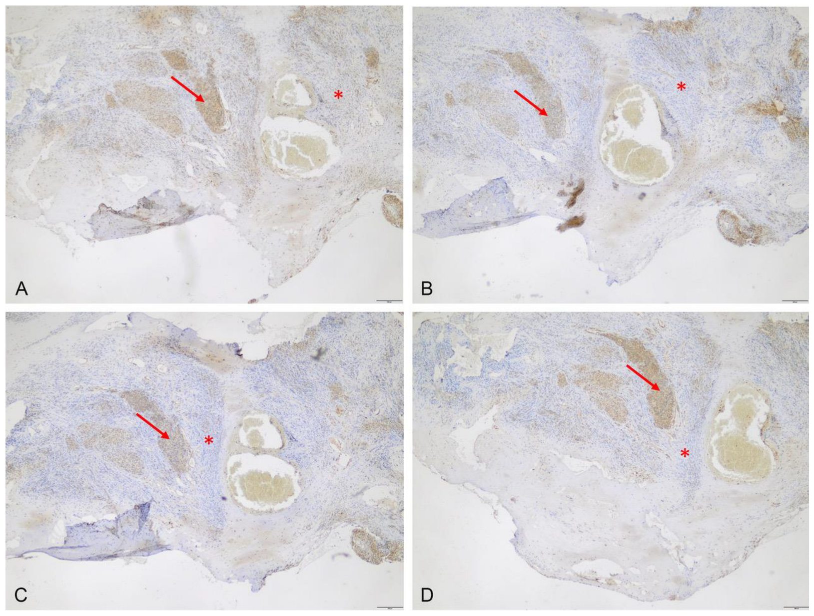 Cancers 15 00304 g004 Cancers 15 00304 g004