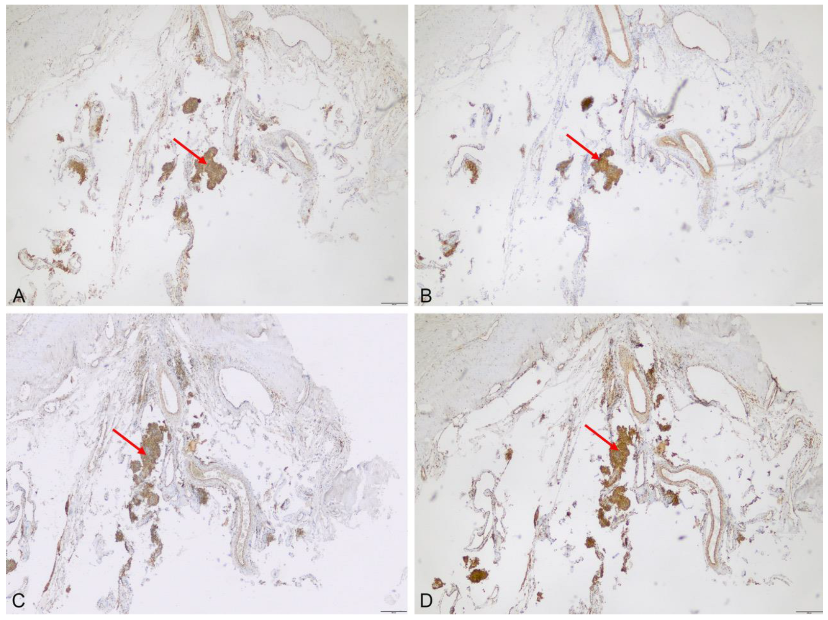 Cancers 15 00304 g005 Cancers 15 00304 g005