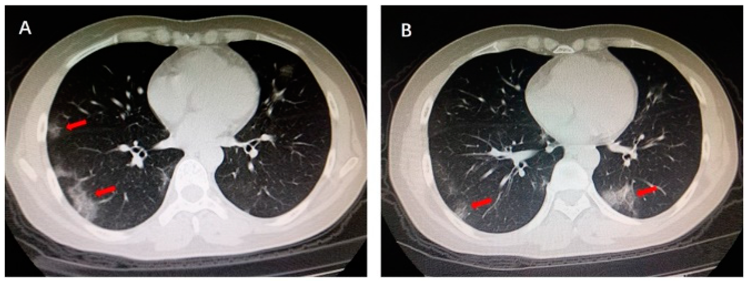 Cancers 15 00314 g005
