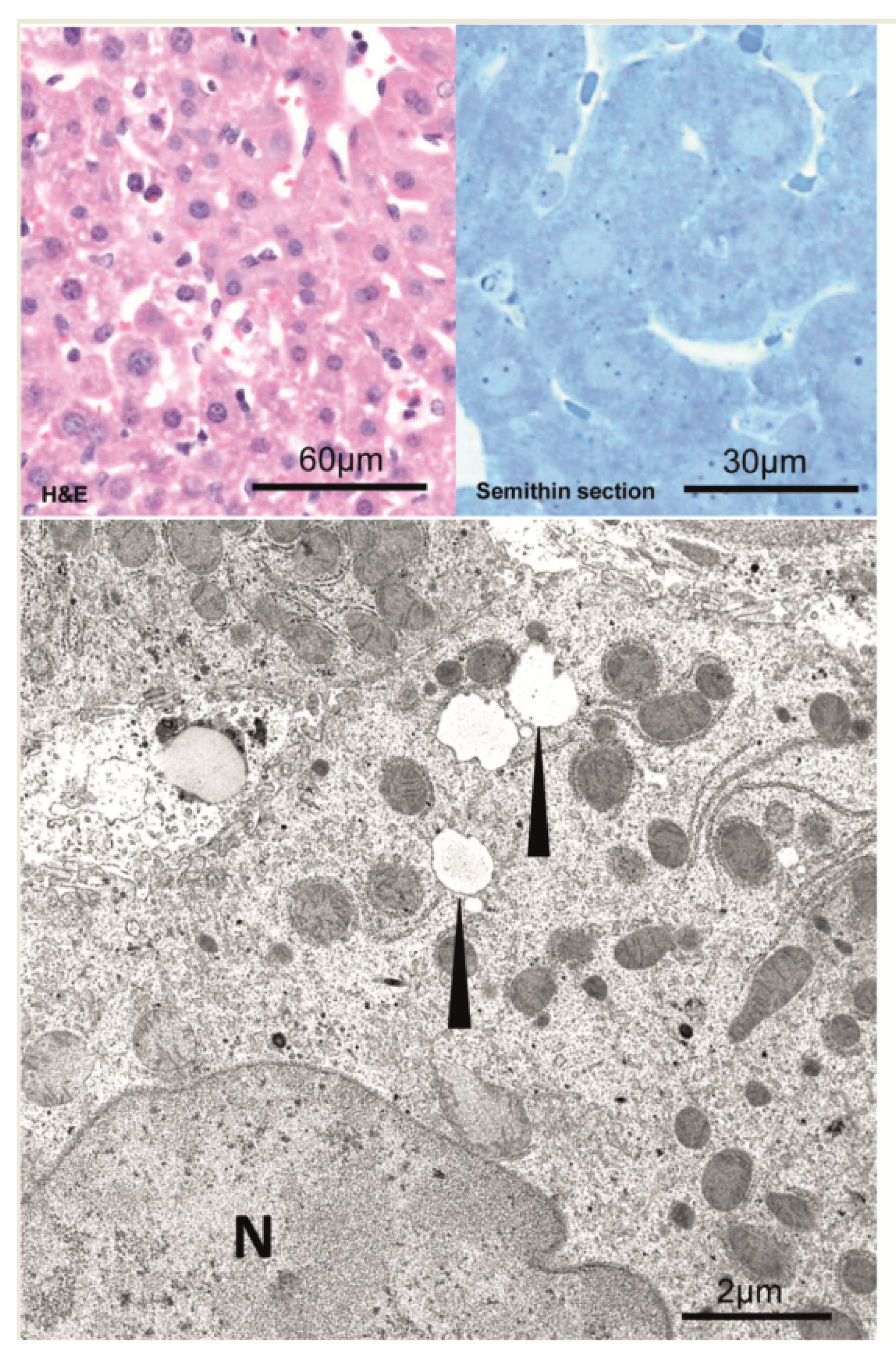 Cancers 15 00328 g005