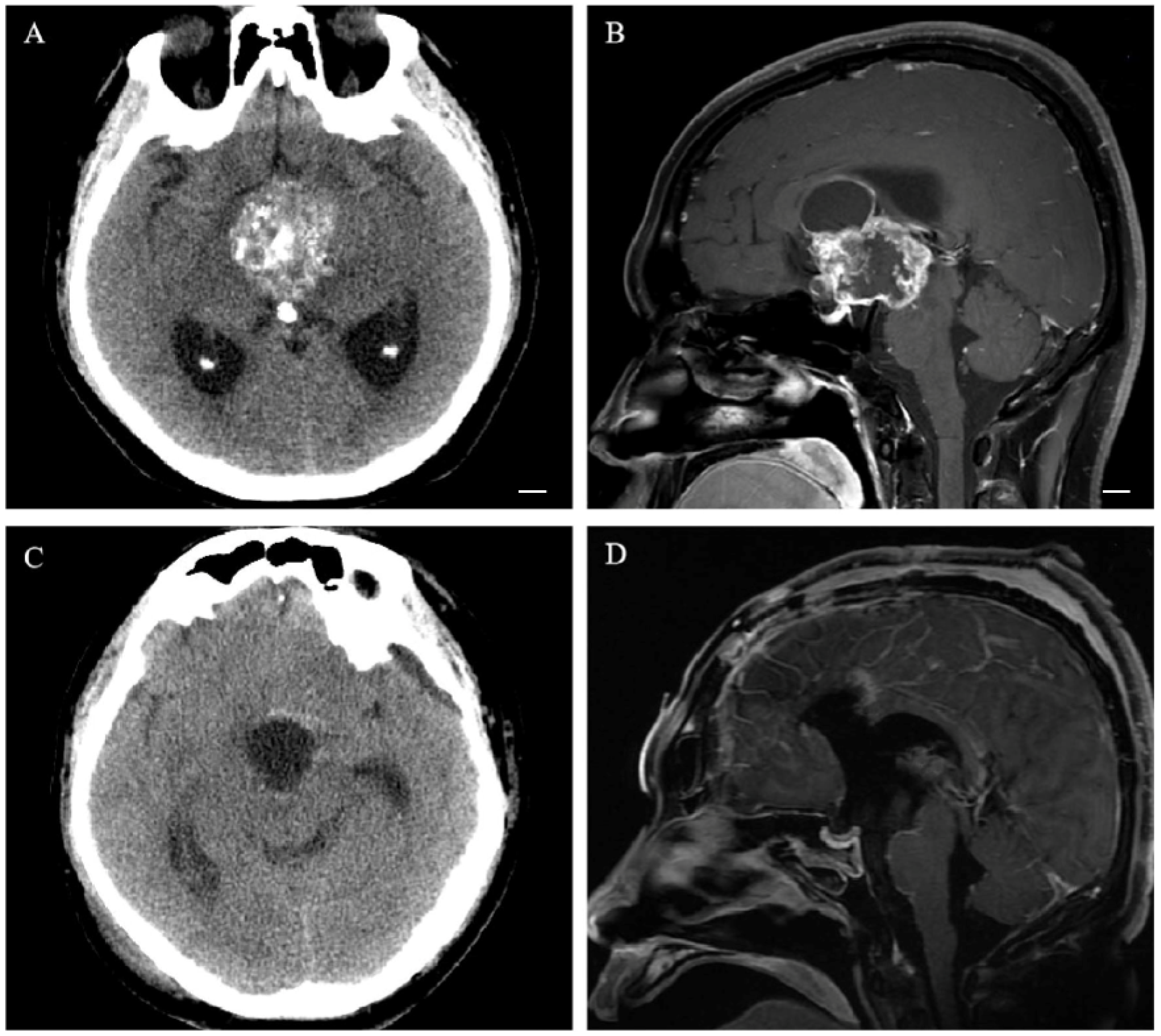 Cancers 15 00340 g002 Cancers 15 00340 g002