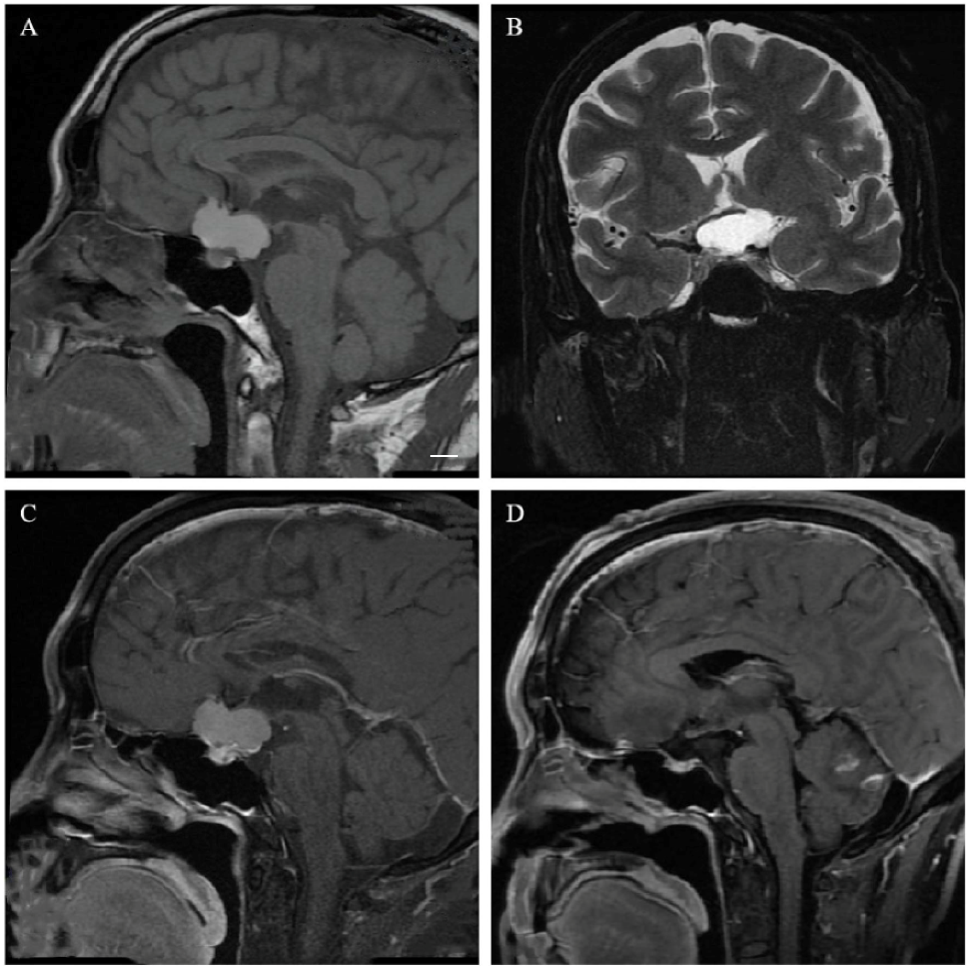 Cancers 15 00340 g003 Cancers 15 00340 g003