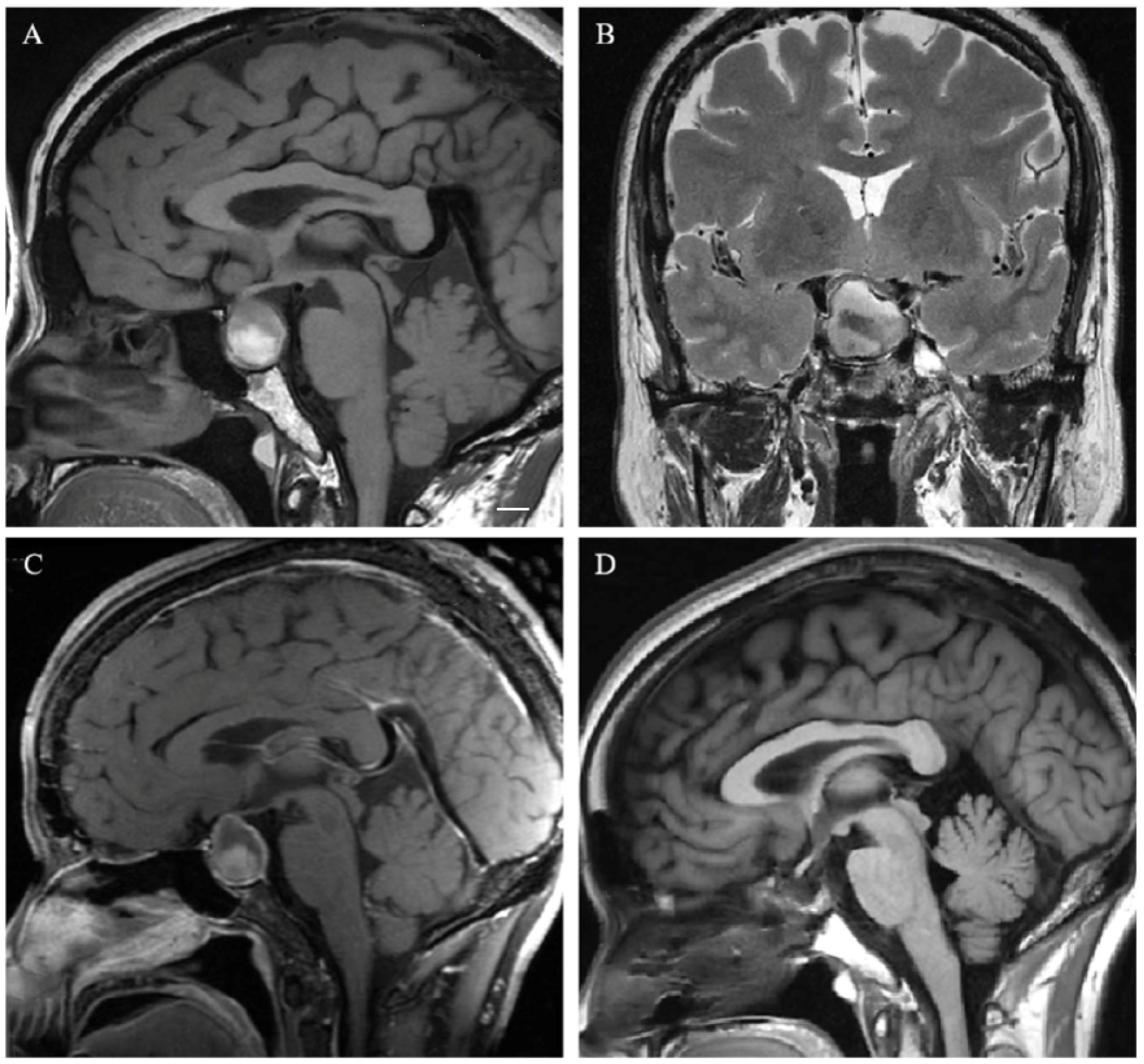 Cancers 15 00340 g004 Cancers 15 00340 g004