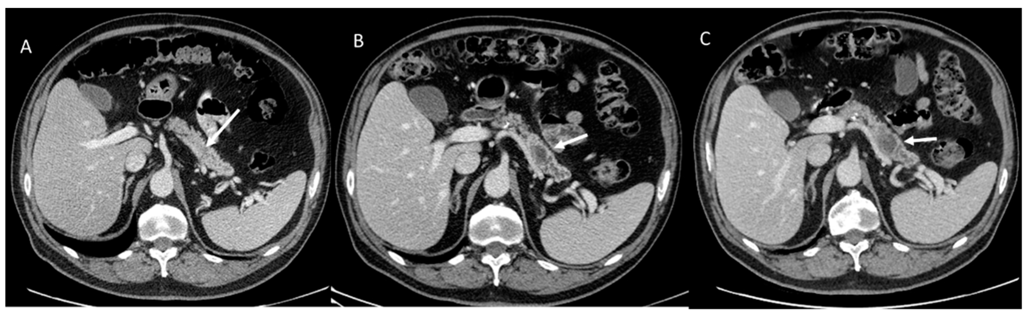 Cancers 15 00351 g001 Cancers 15 00351 g001