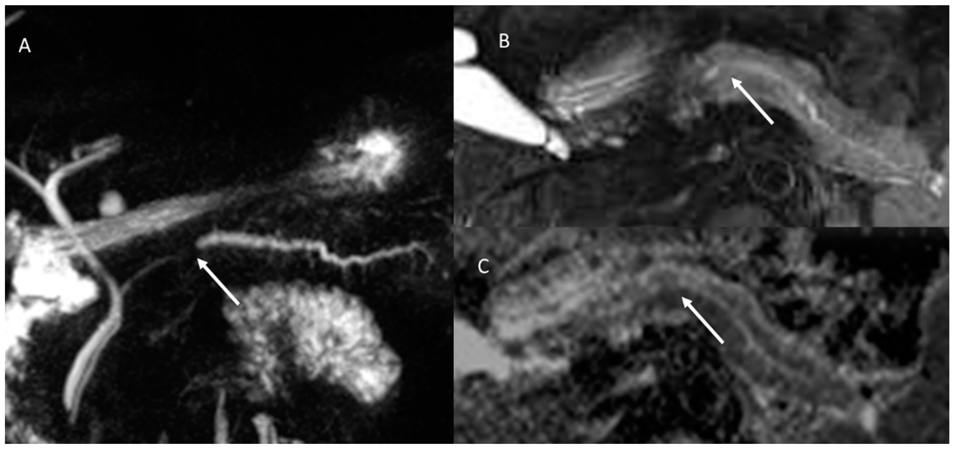 Cancers 15 00351 g002 Cancers 15 00351 g002