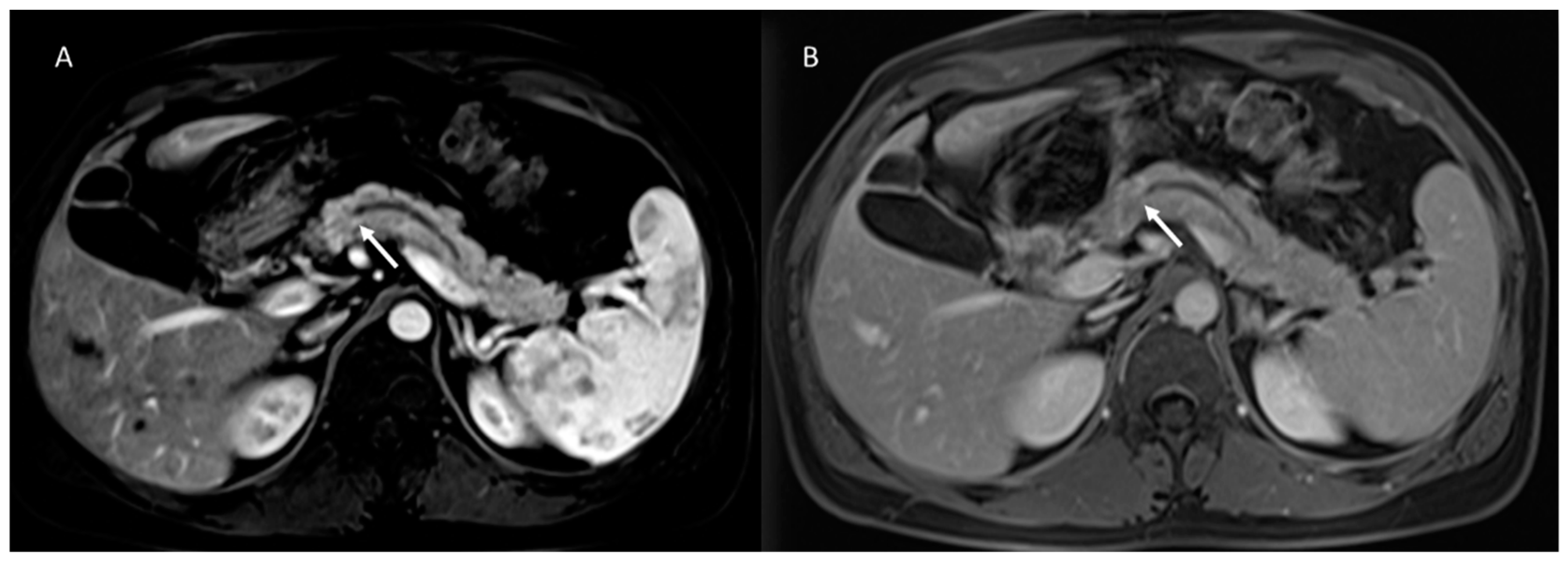 Cancers 15 00351 g003 Cancers 15 00351 g003