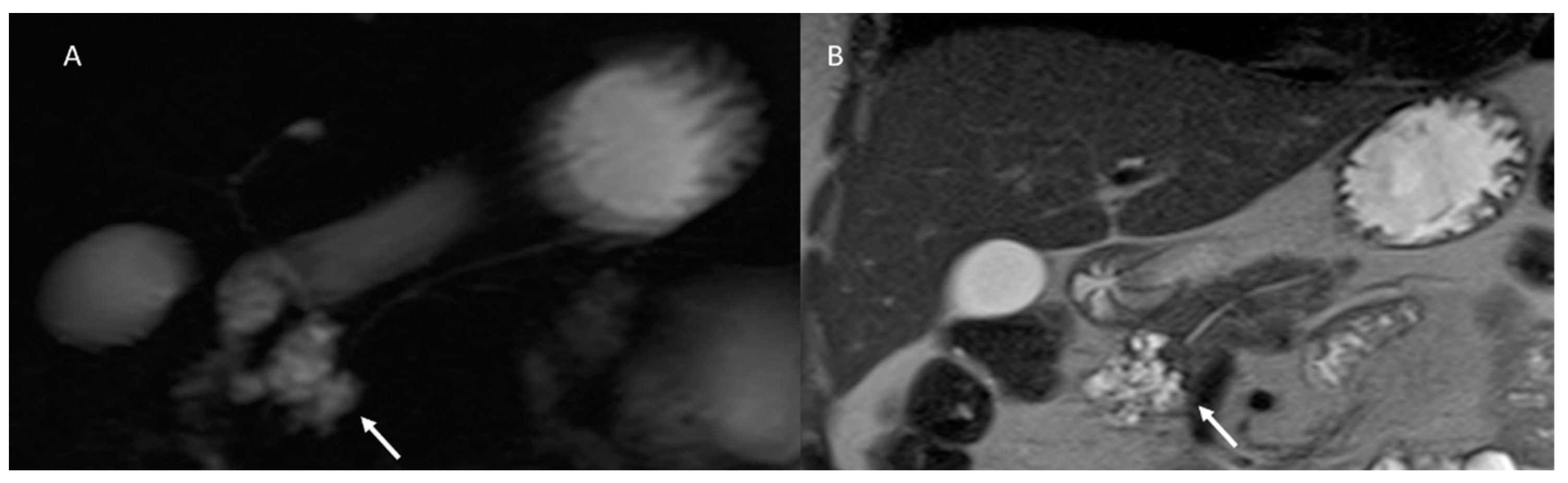 Cancers 15 00351 g006 Cancers 15 00351 g006