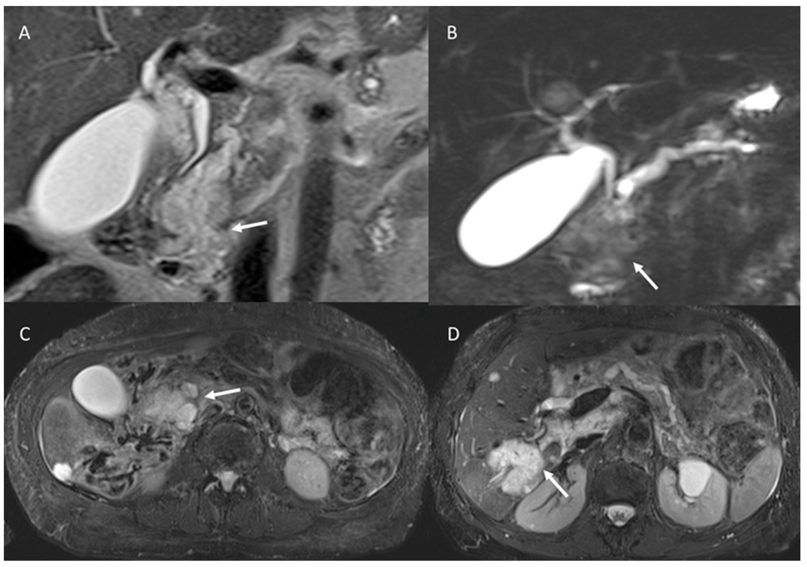 Cancers 15 00351 g007 Cancers 15 00351 g007