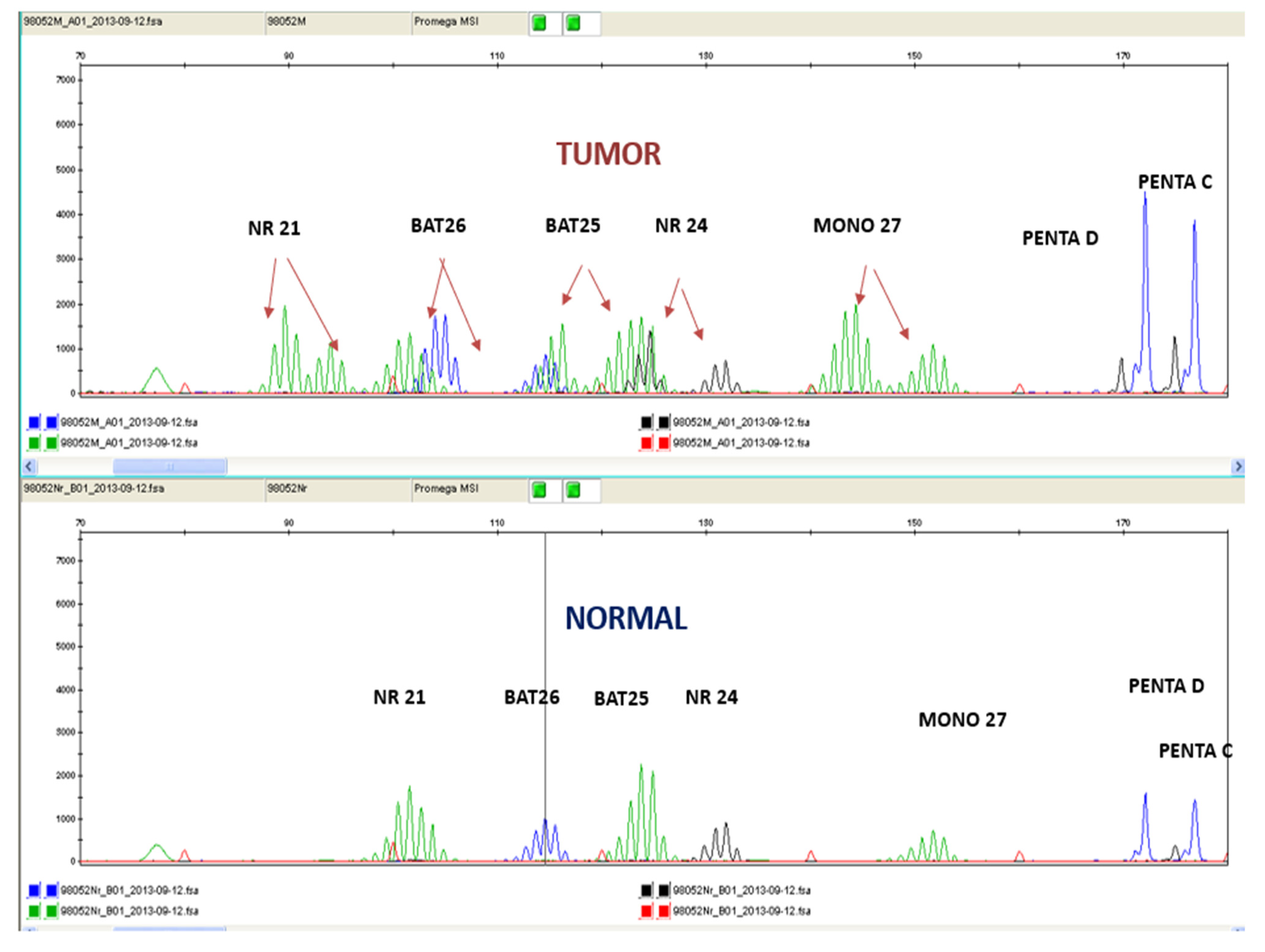 Cancers 15 00353 g002