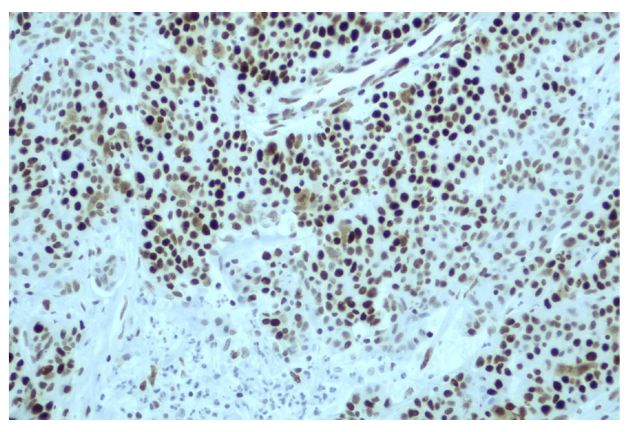 Cancers 15 00353 g004