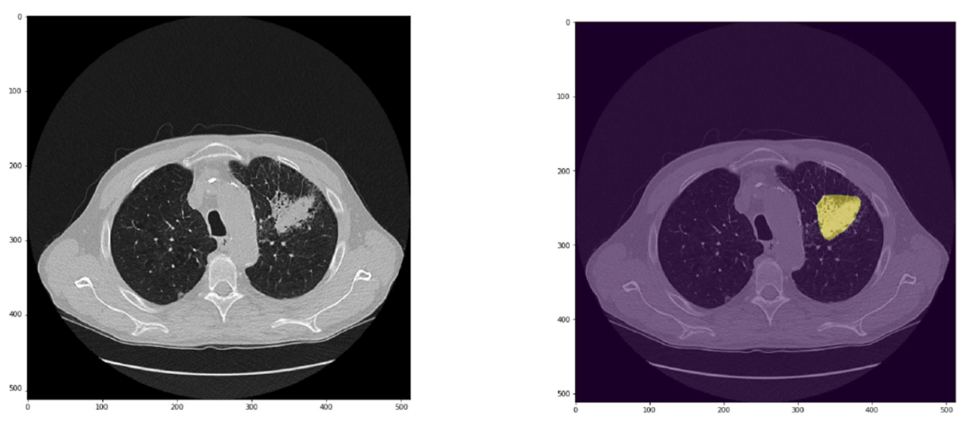 Cancers 15 00357 g007