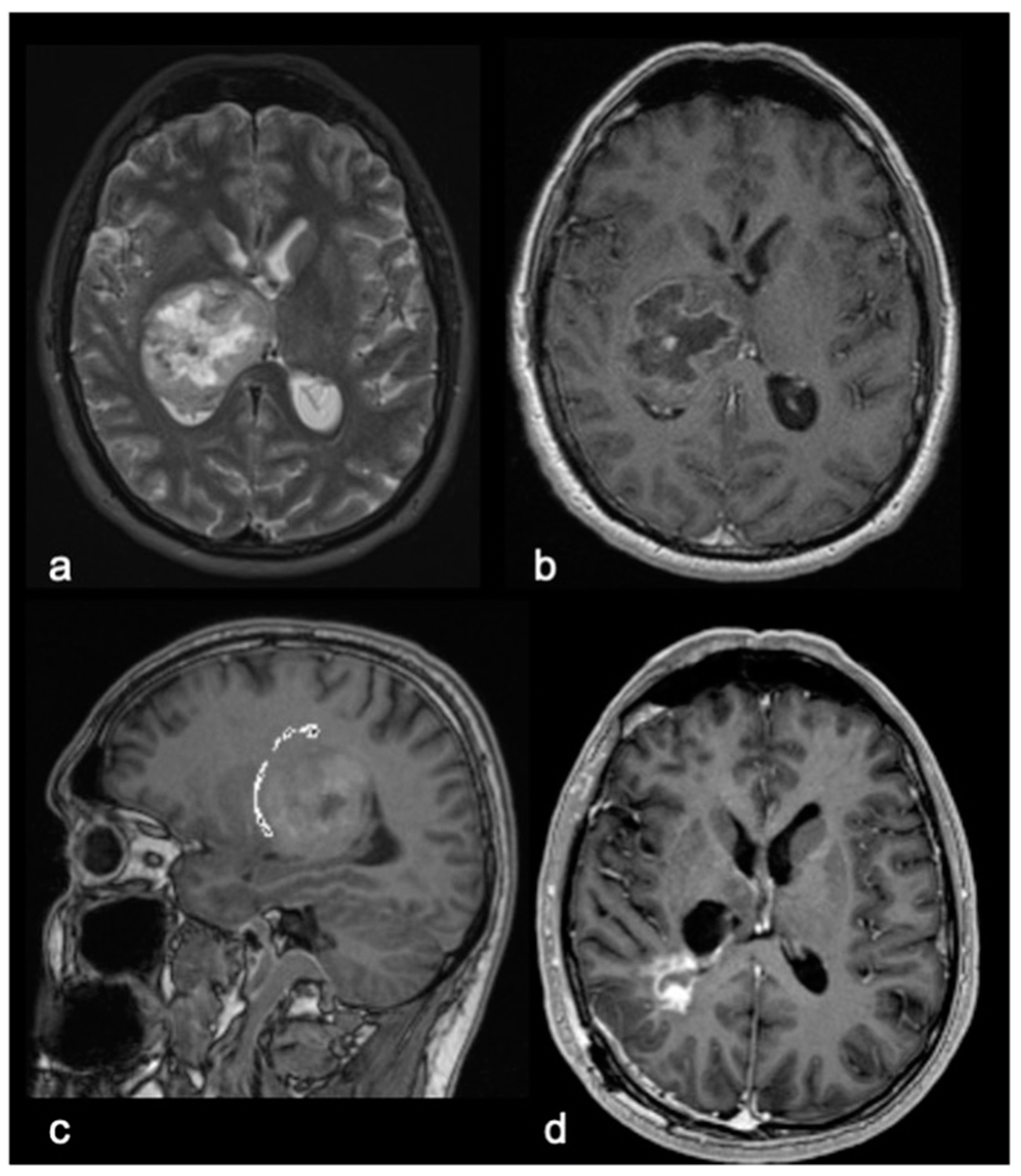 Cancers 15 00361 g001 Cancers 15 00361 g001