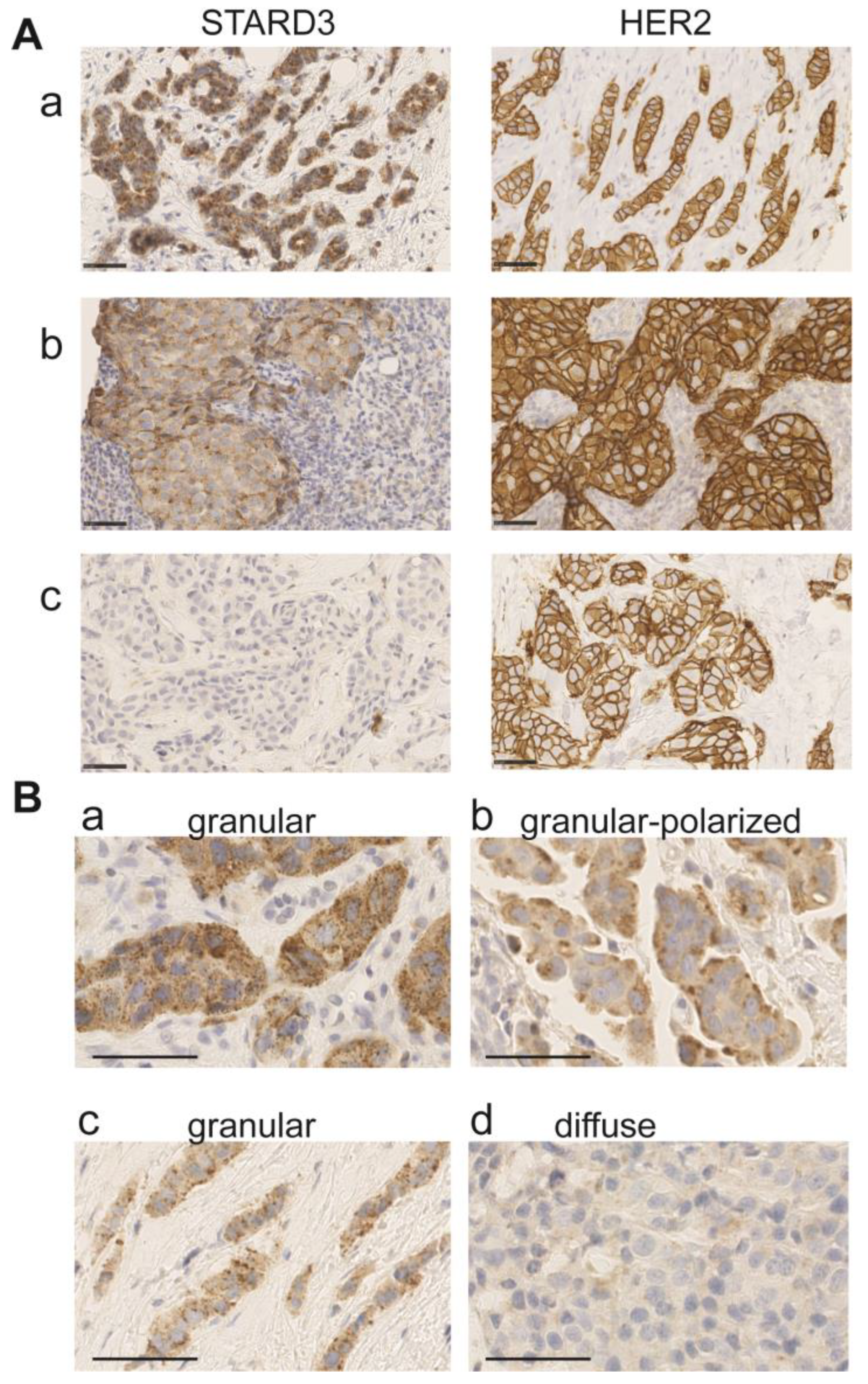 Cancers 15 00362 g004