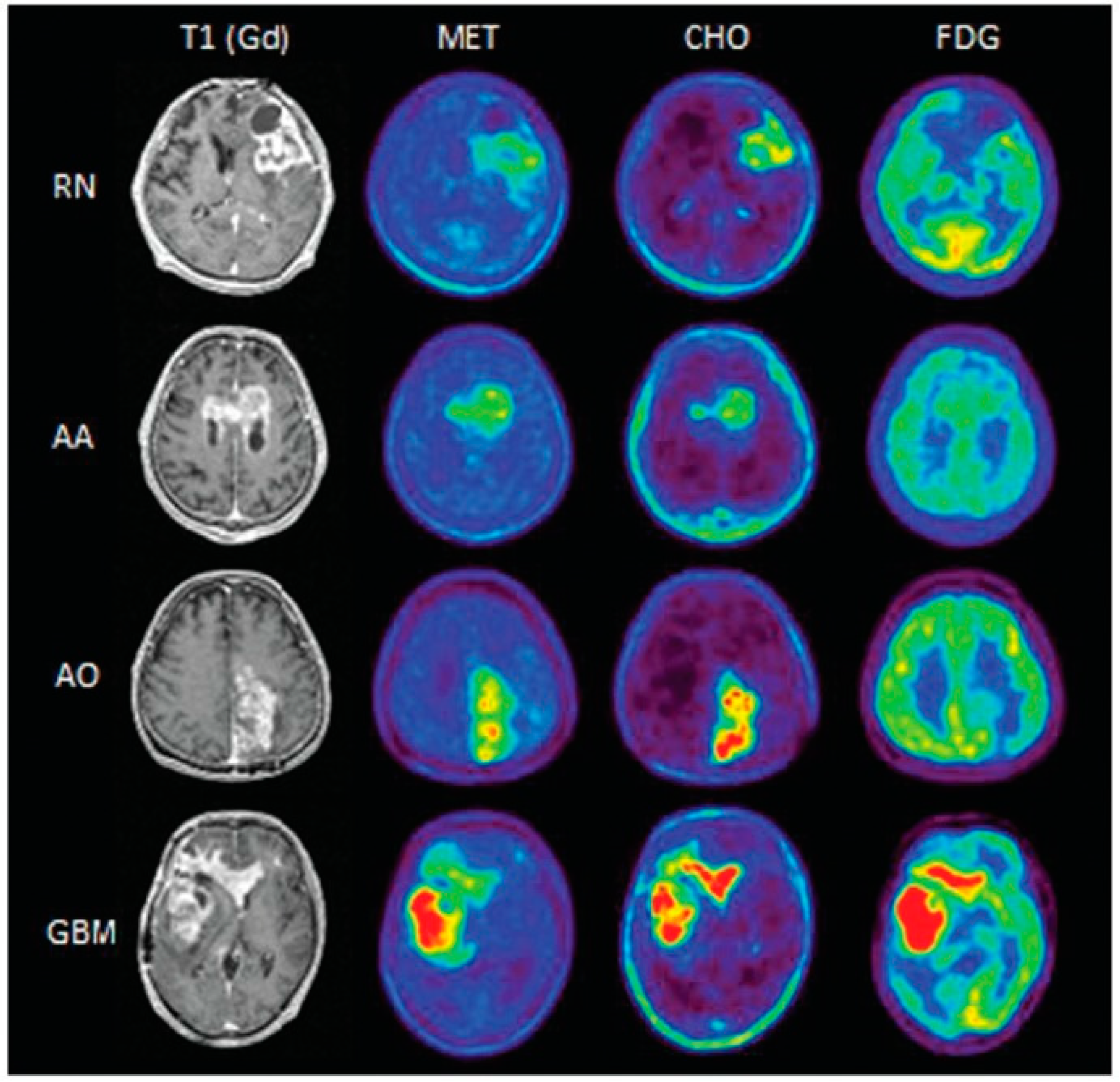 Cancers 15 00364 g004 Cancers 15 00364 g004