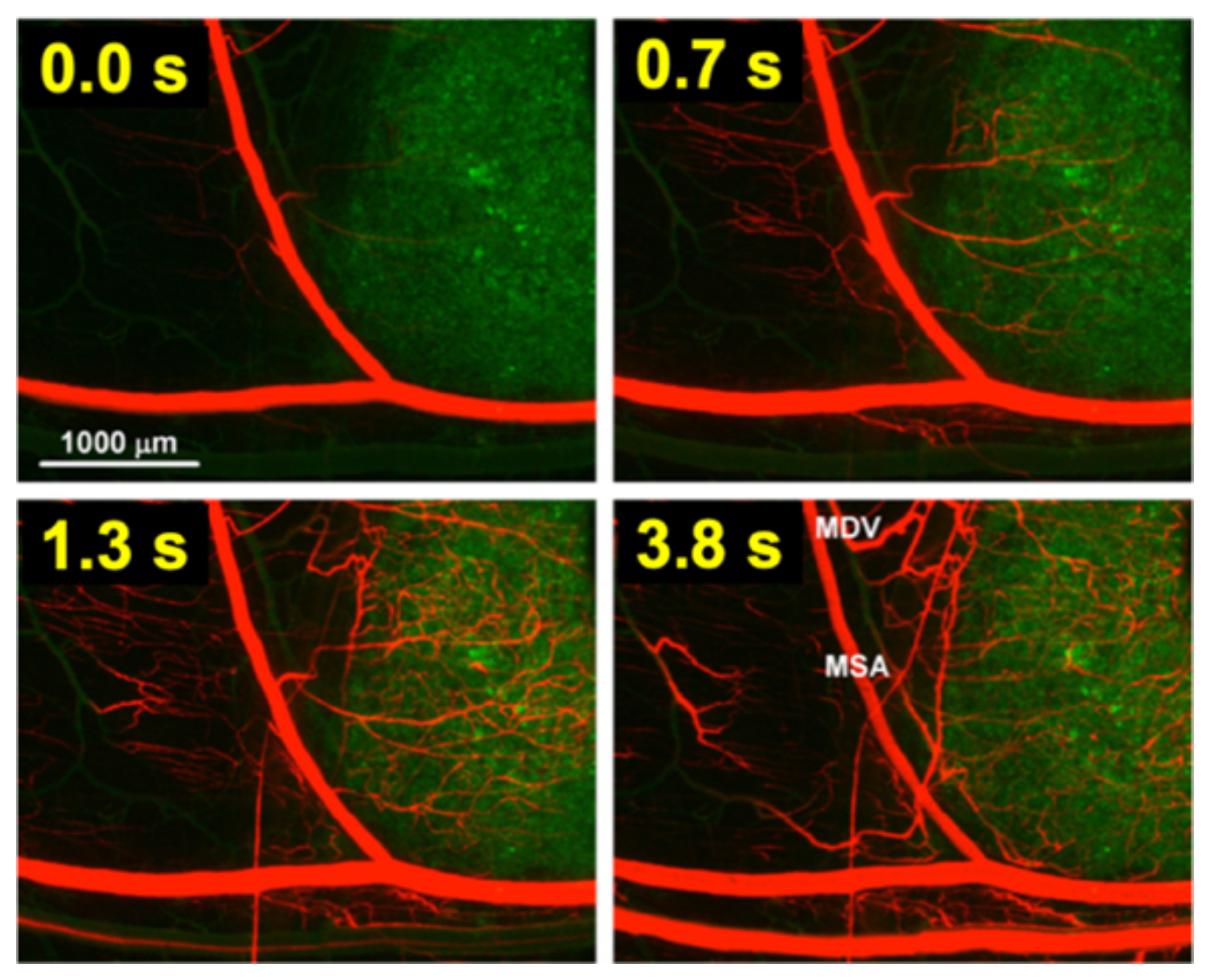 Cancers 15 00398 g004 Cancers 15 00398 g004