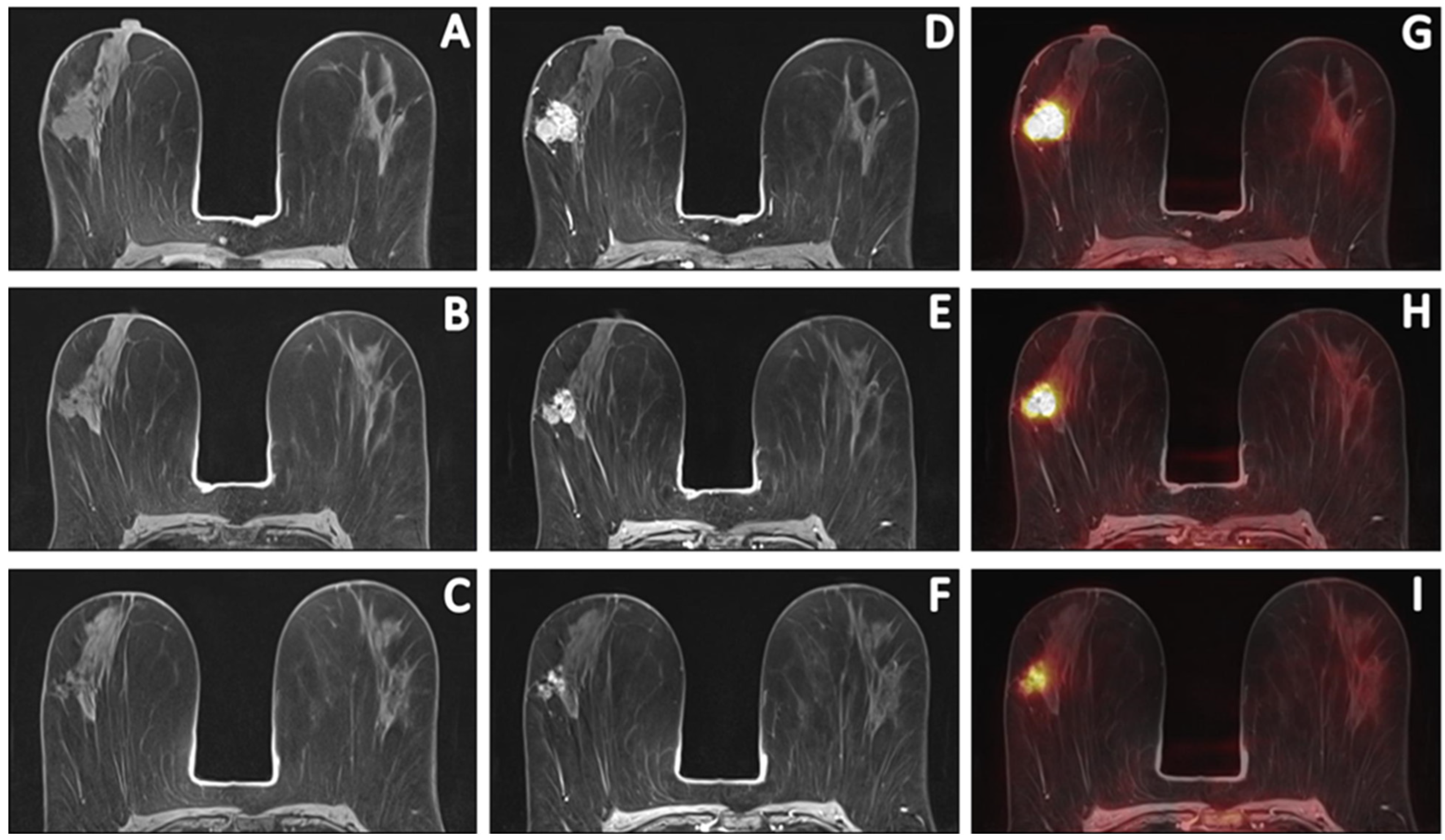 Cancers 15 00401 g002 Cancers 15 00401 g002