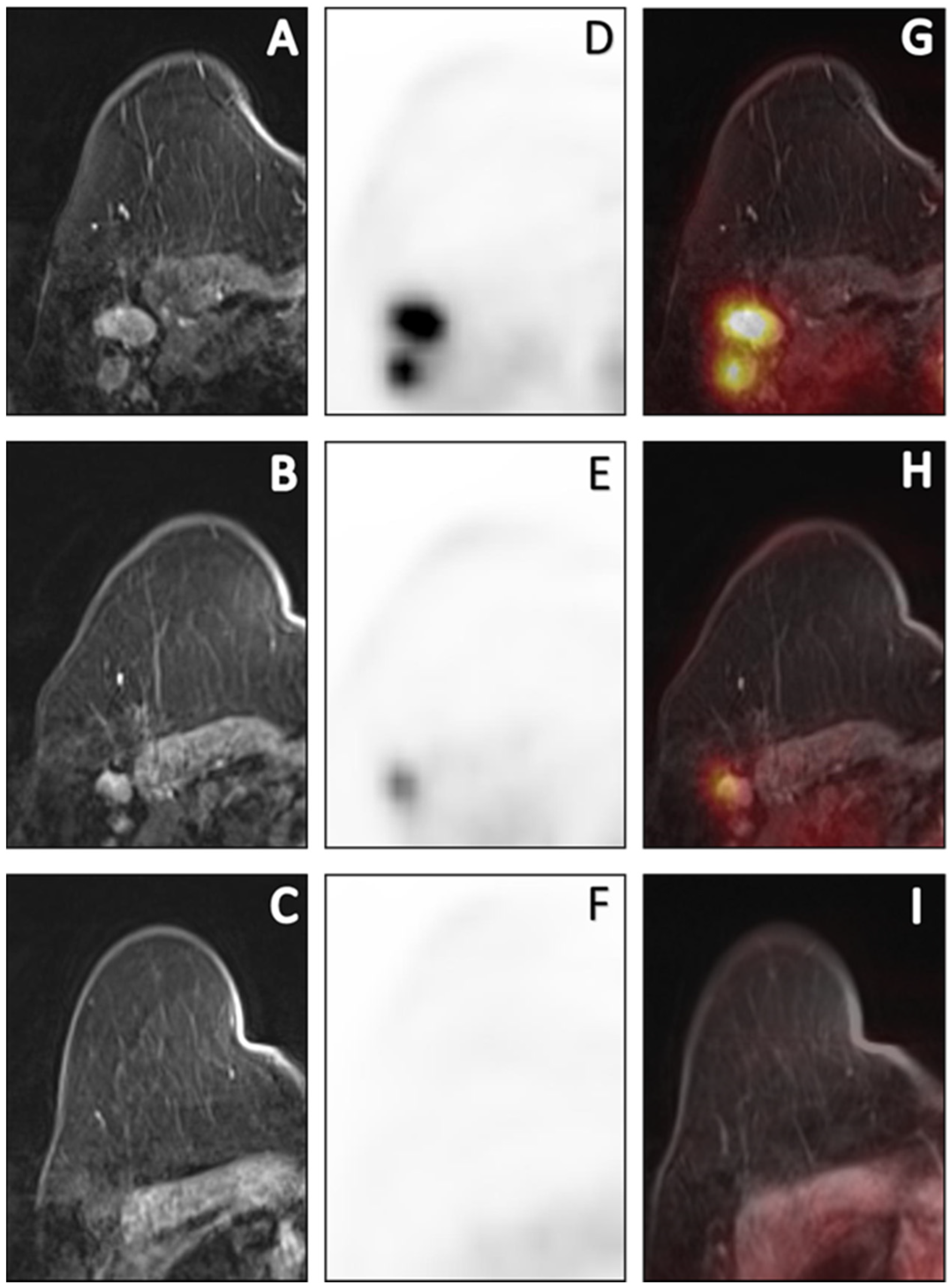 Cancers 15 00401 g003 Cancers 15 00401 g003