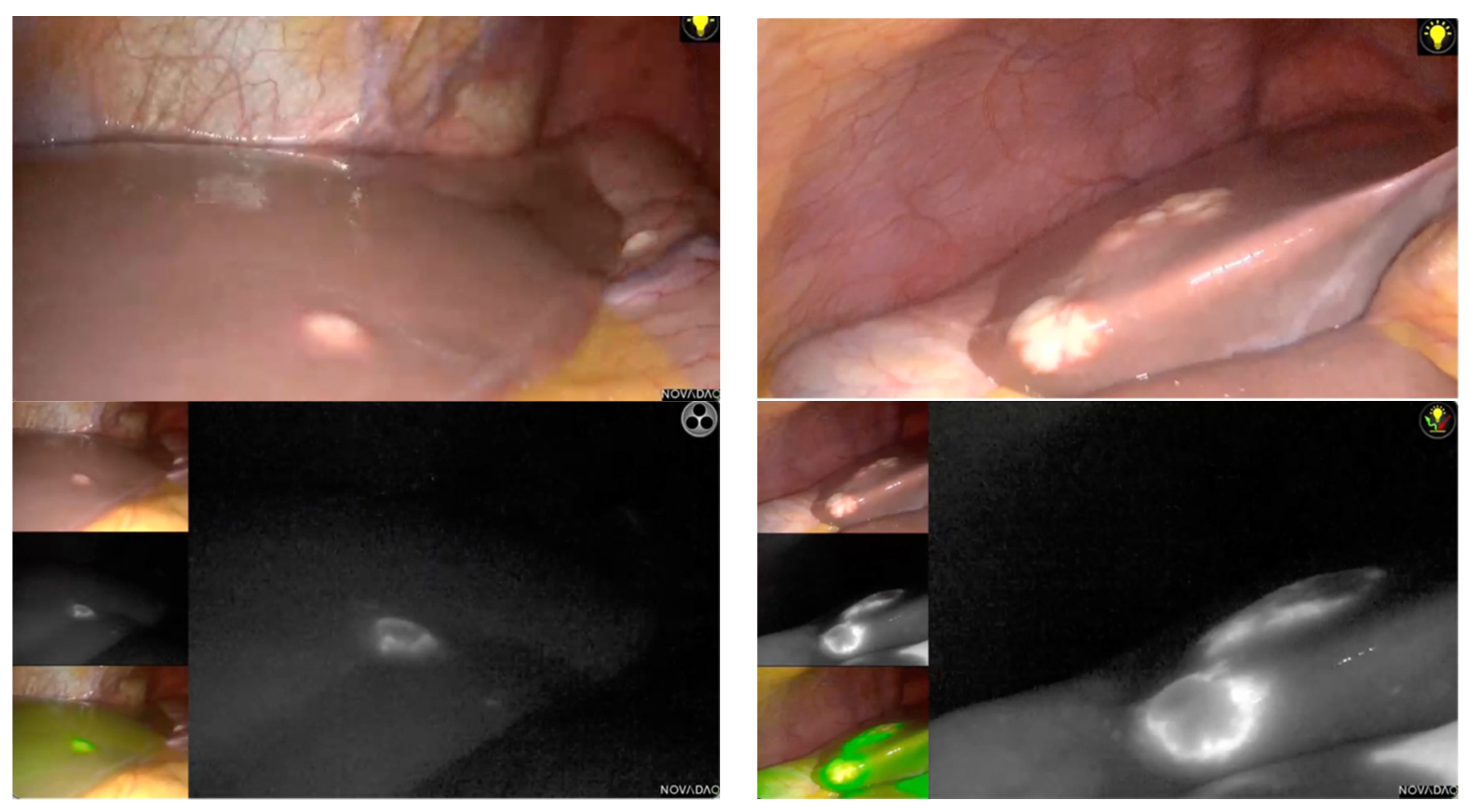 Cancers 15 00435 g002 Cancers 15 00435 g002