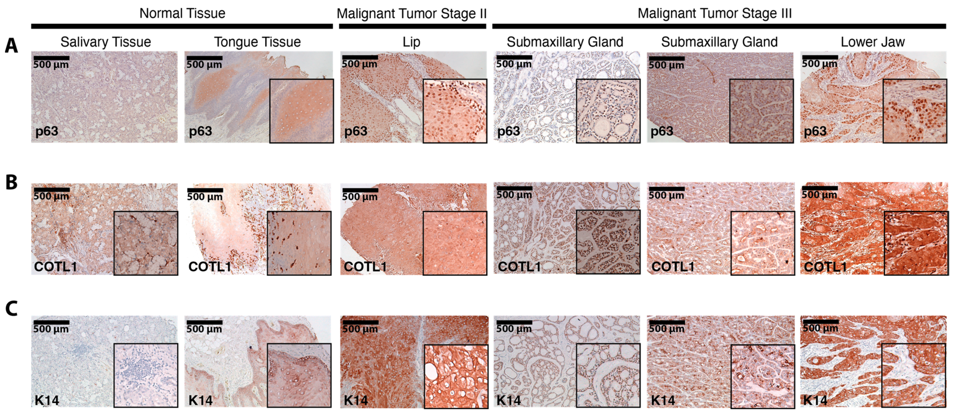 Cancers 15 00446 g011 Cancers 15 00446 g011