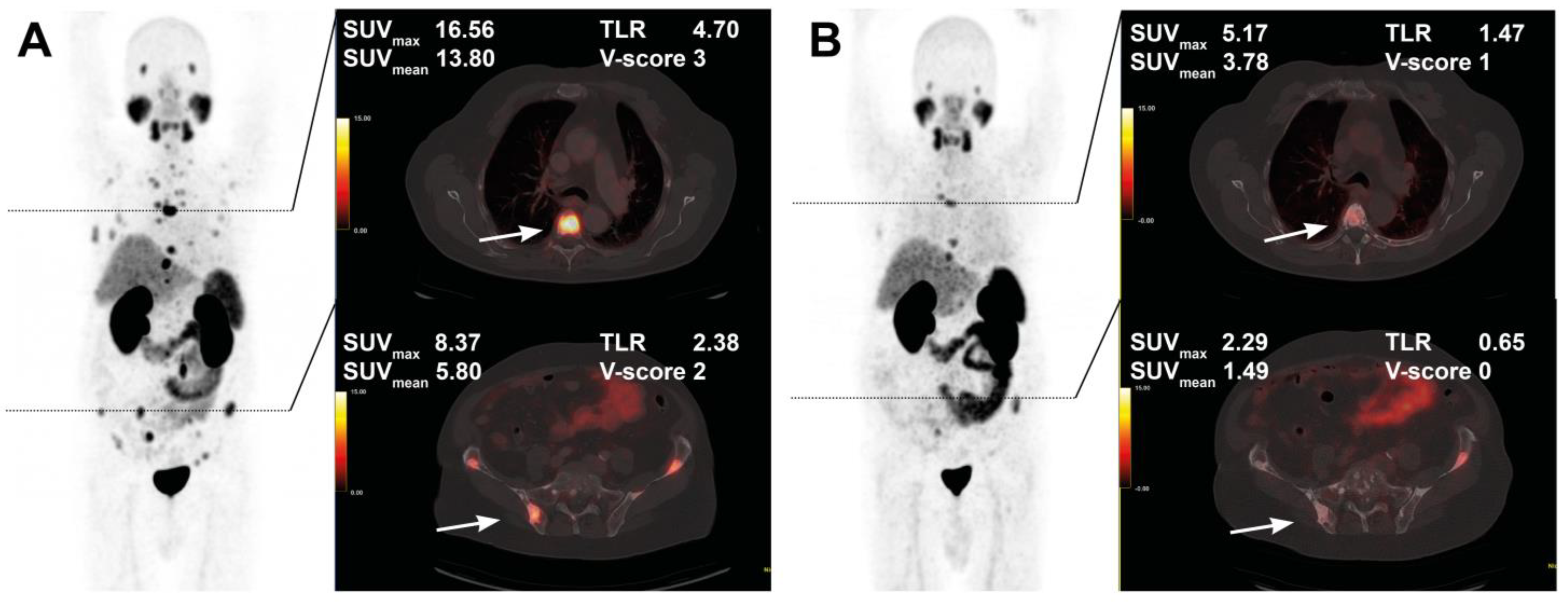 Cancers 15 00473 g004