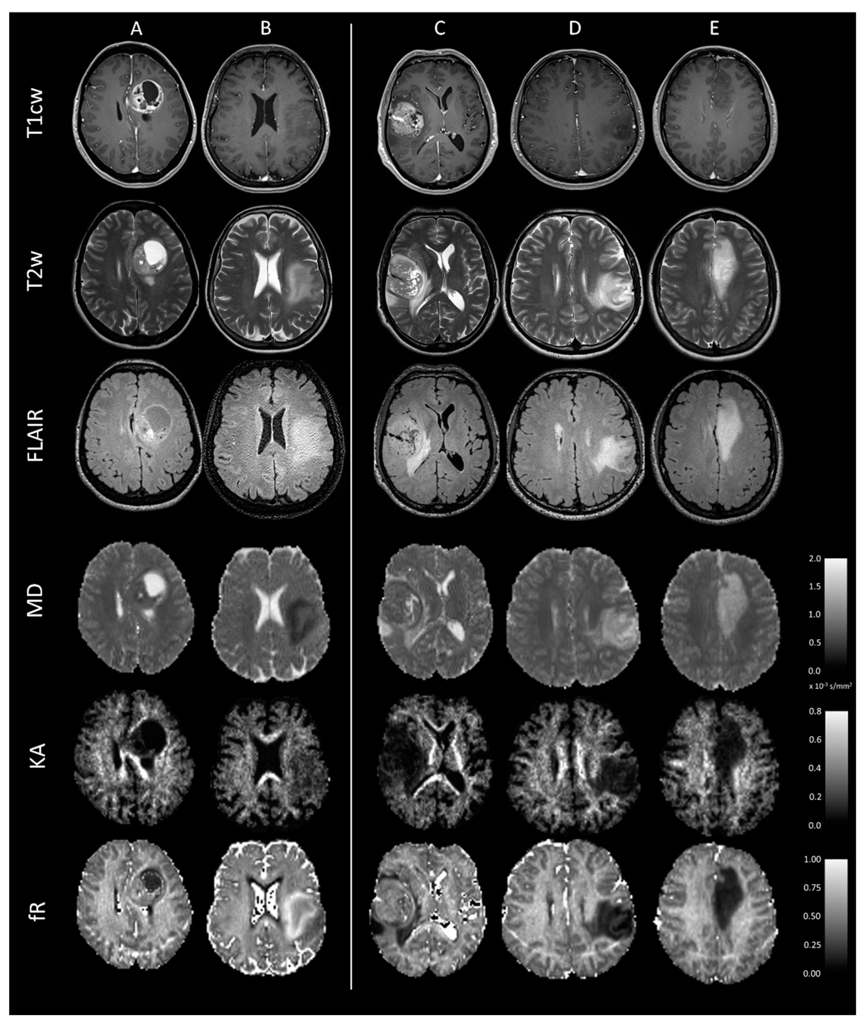 Cancers 15 00482 g001 Cancers 15 00482 g001