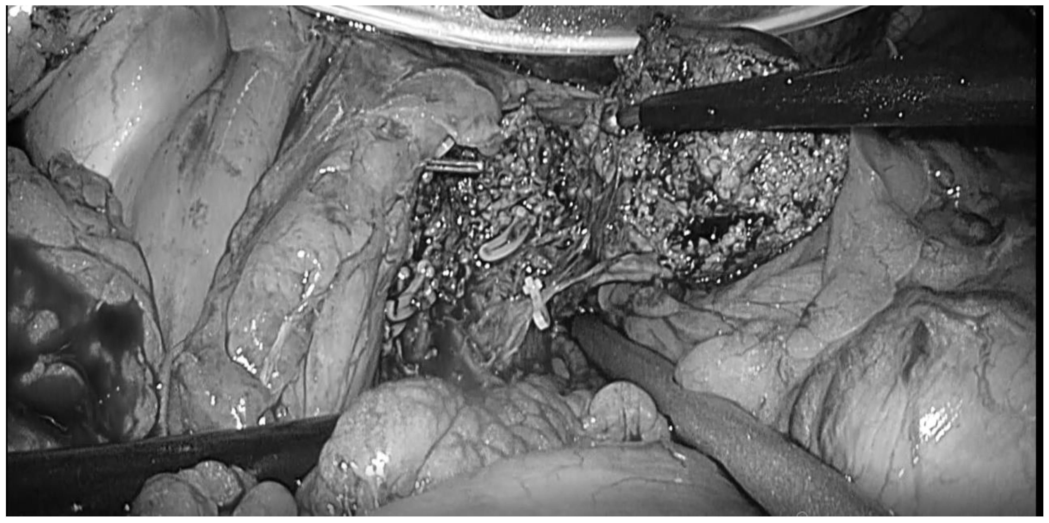 Cancers 15 00488 g003