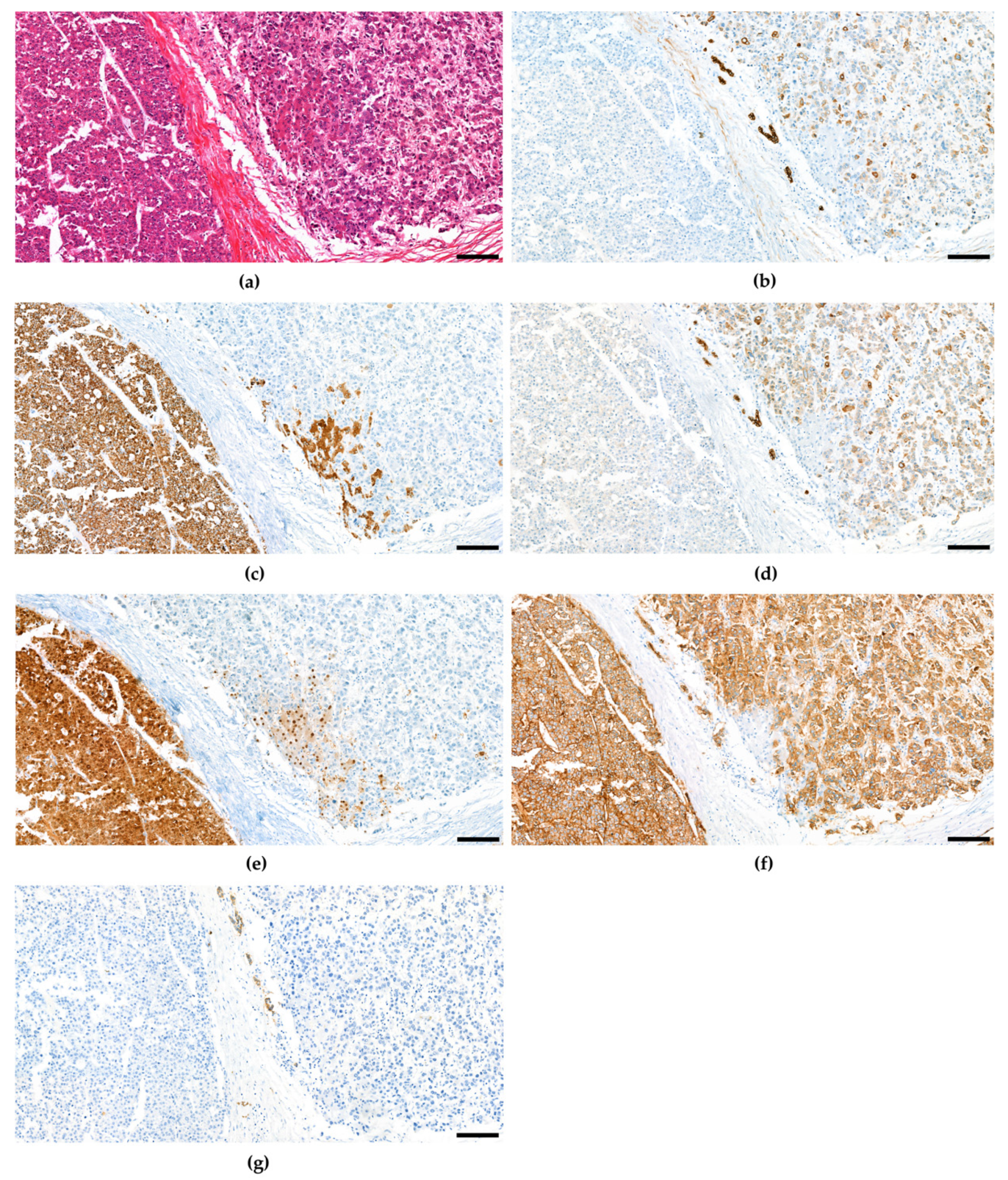 Cancers 15 00494 g002 Cancers 15 00494 g002