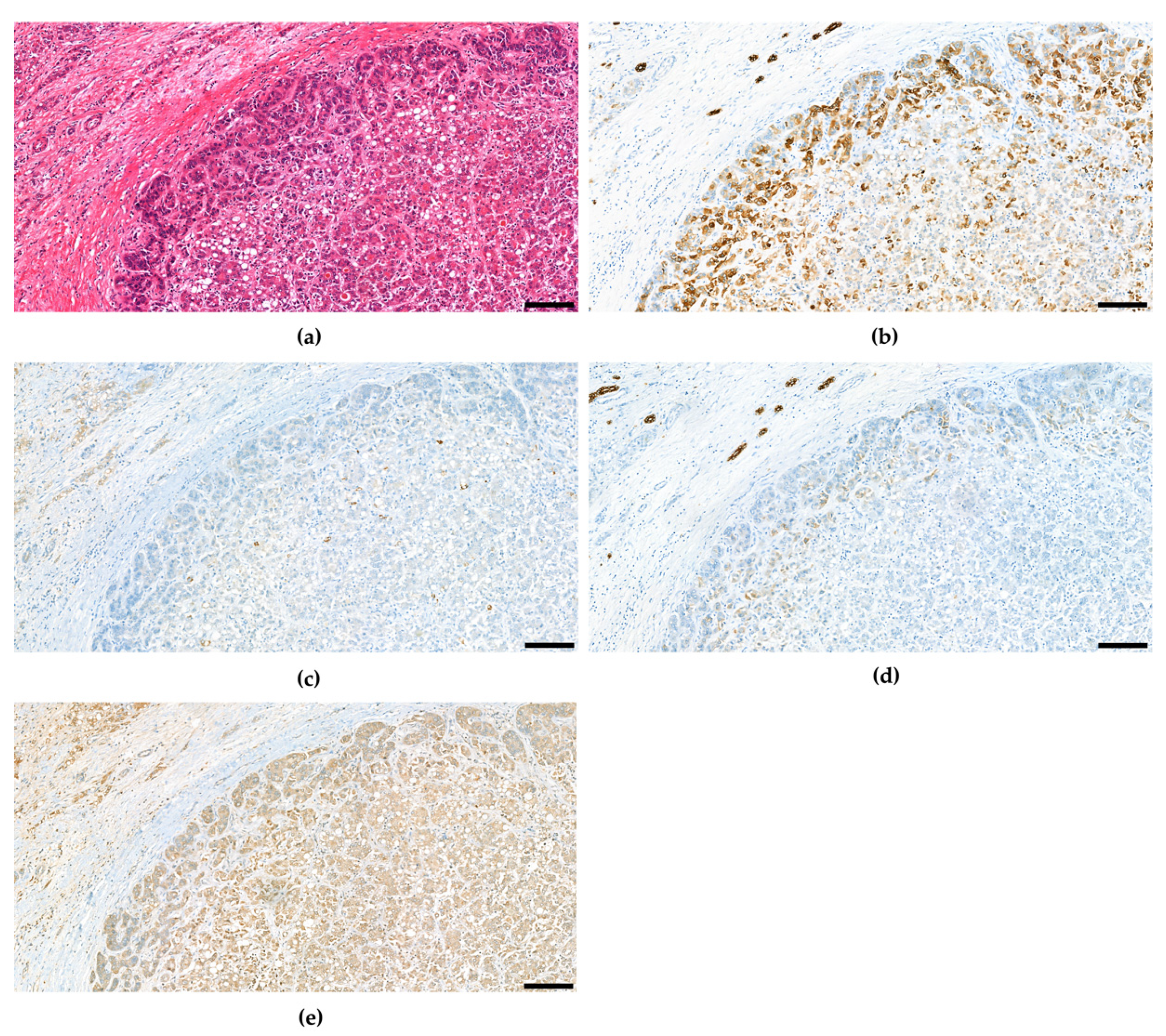 Cancers 15 00494 g003 Cancers 15 00494 g003