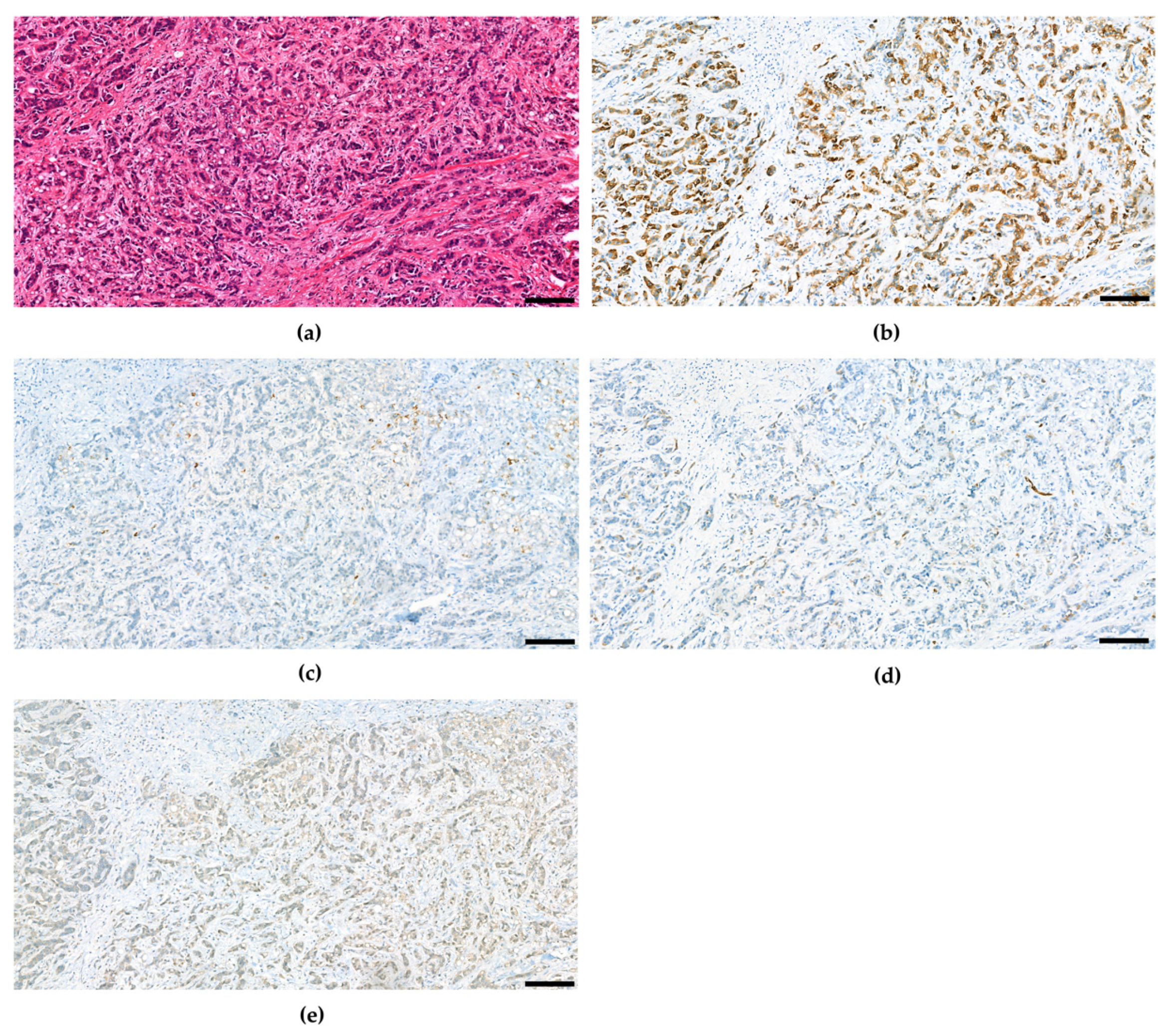 Cancers 15 00494 g004 Cancers 15 00494 g004