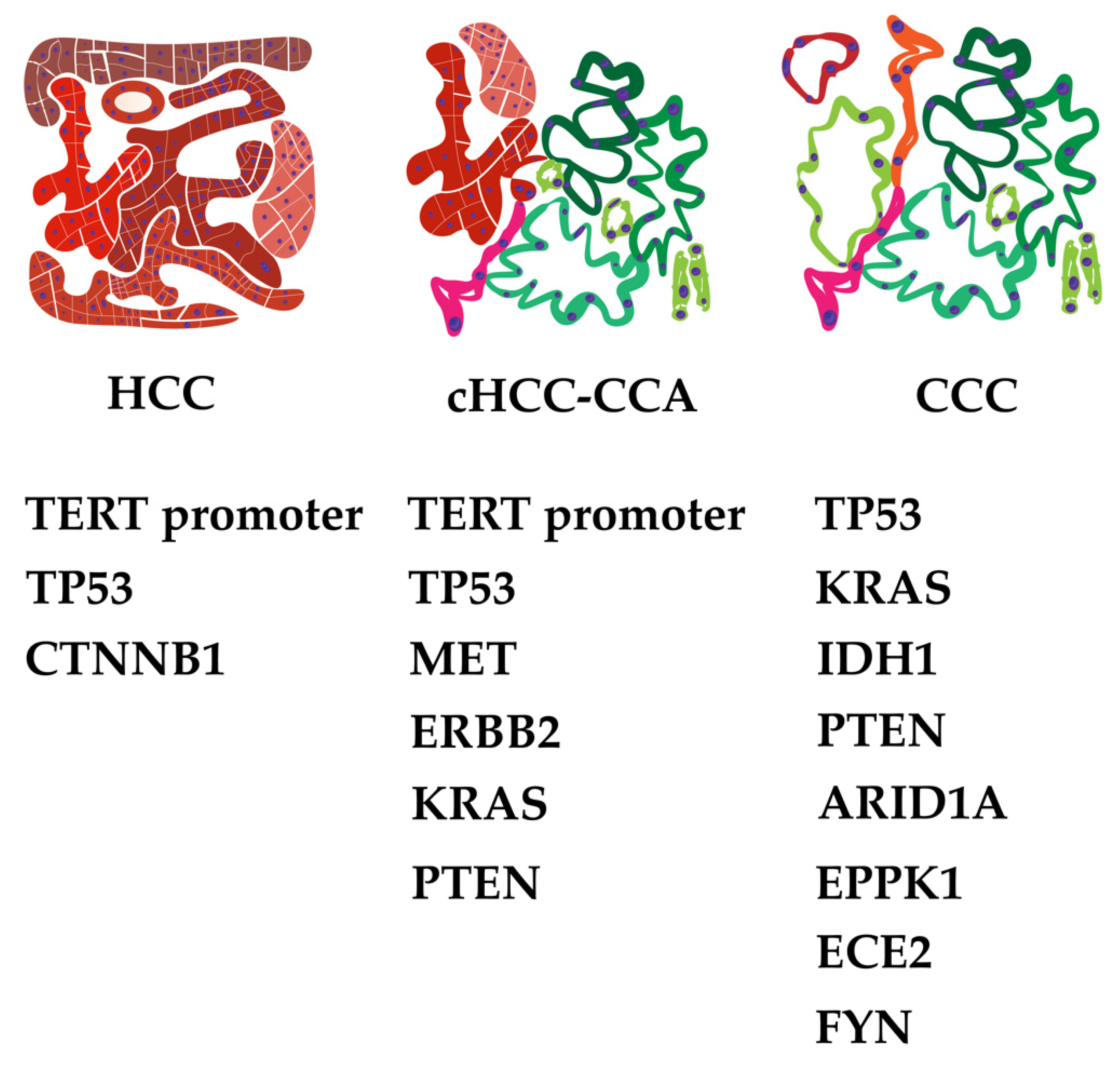 Cancers free full text pathology of combined hepatocellular