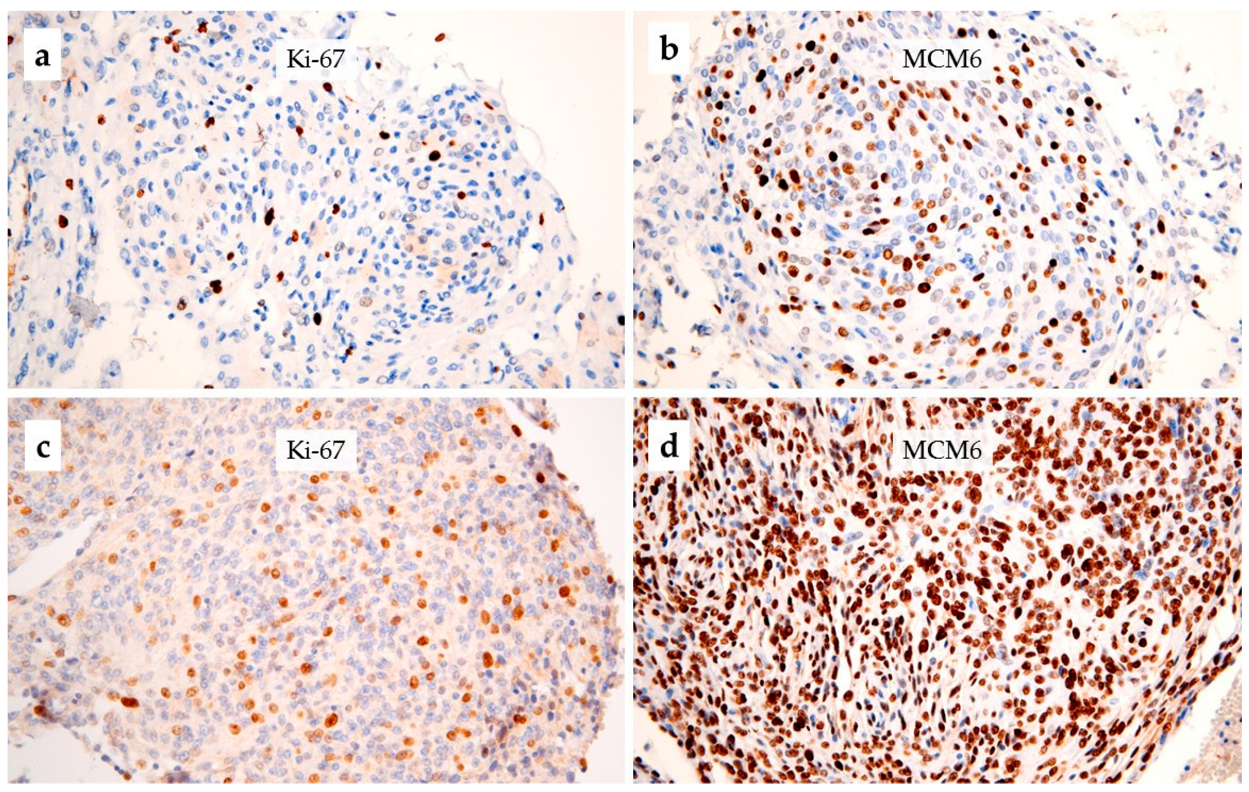 Cancers 15 00535 g002 Cancers 15 00535 g002