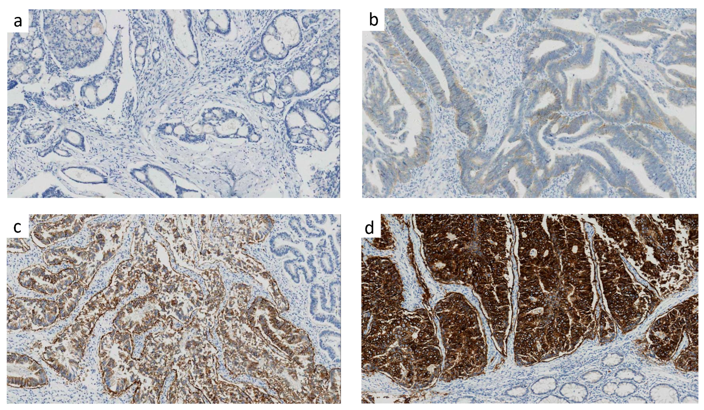 Cancers 15 00554 g002 Cancers 15 00554 g002