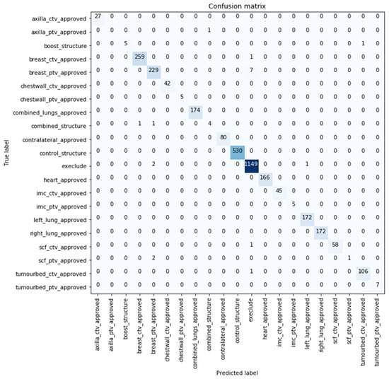 Cancers Free FullText Standardising Breast Radiotherapy Structure