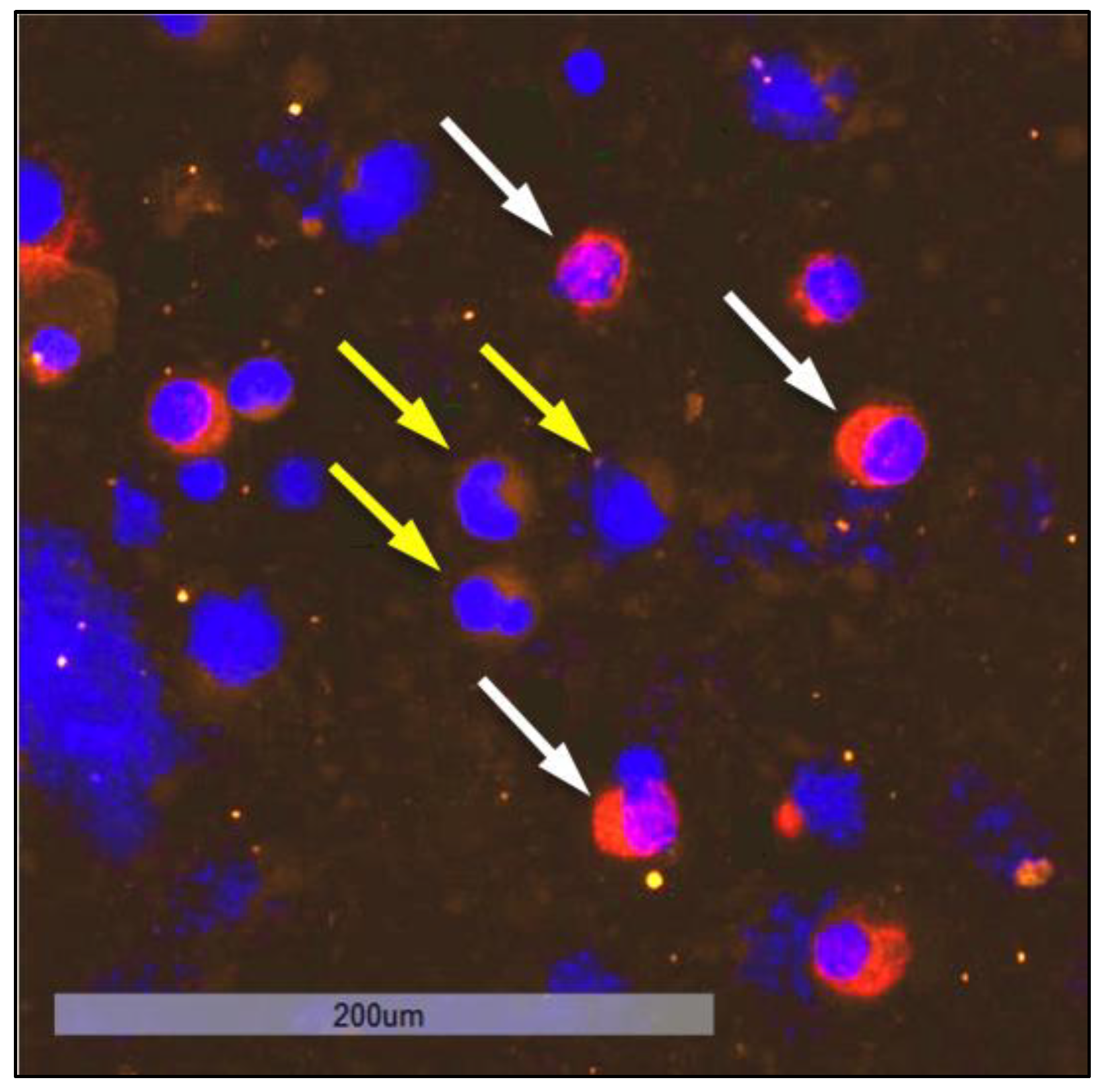 Cancers 15 00568 g004