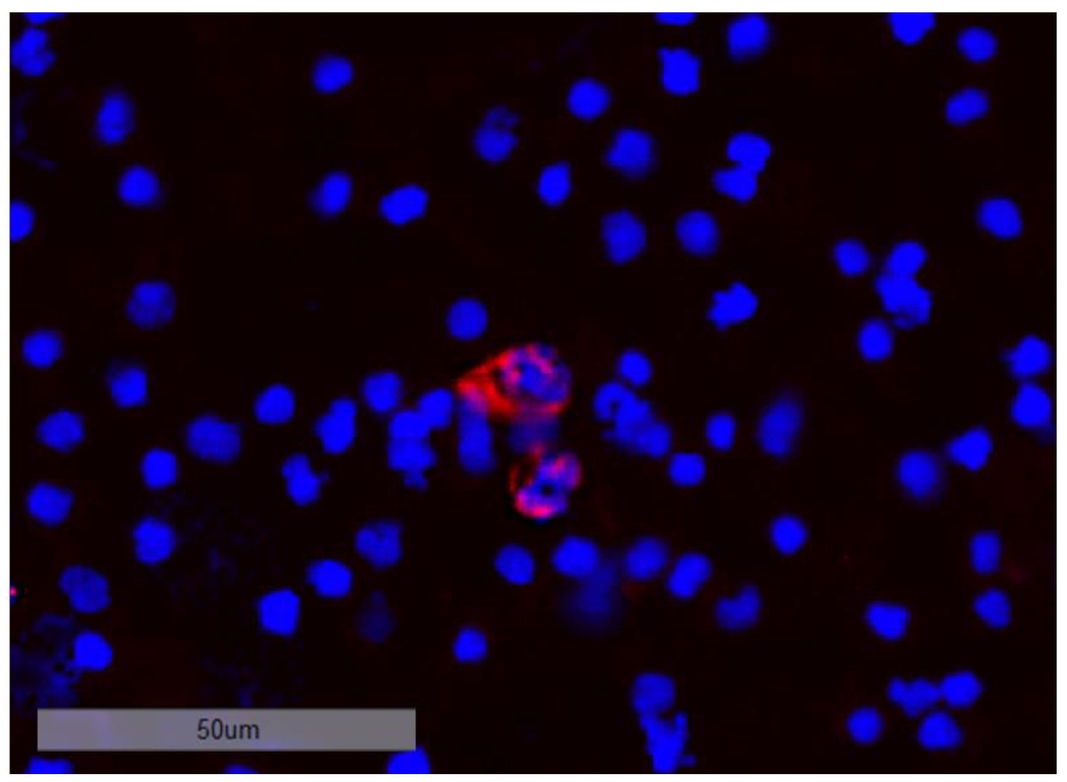 Cancers 15 00568 g009