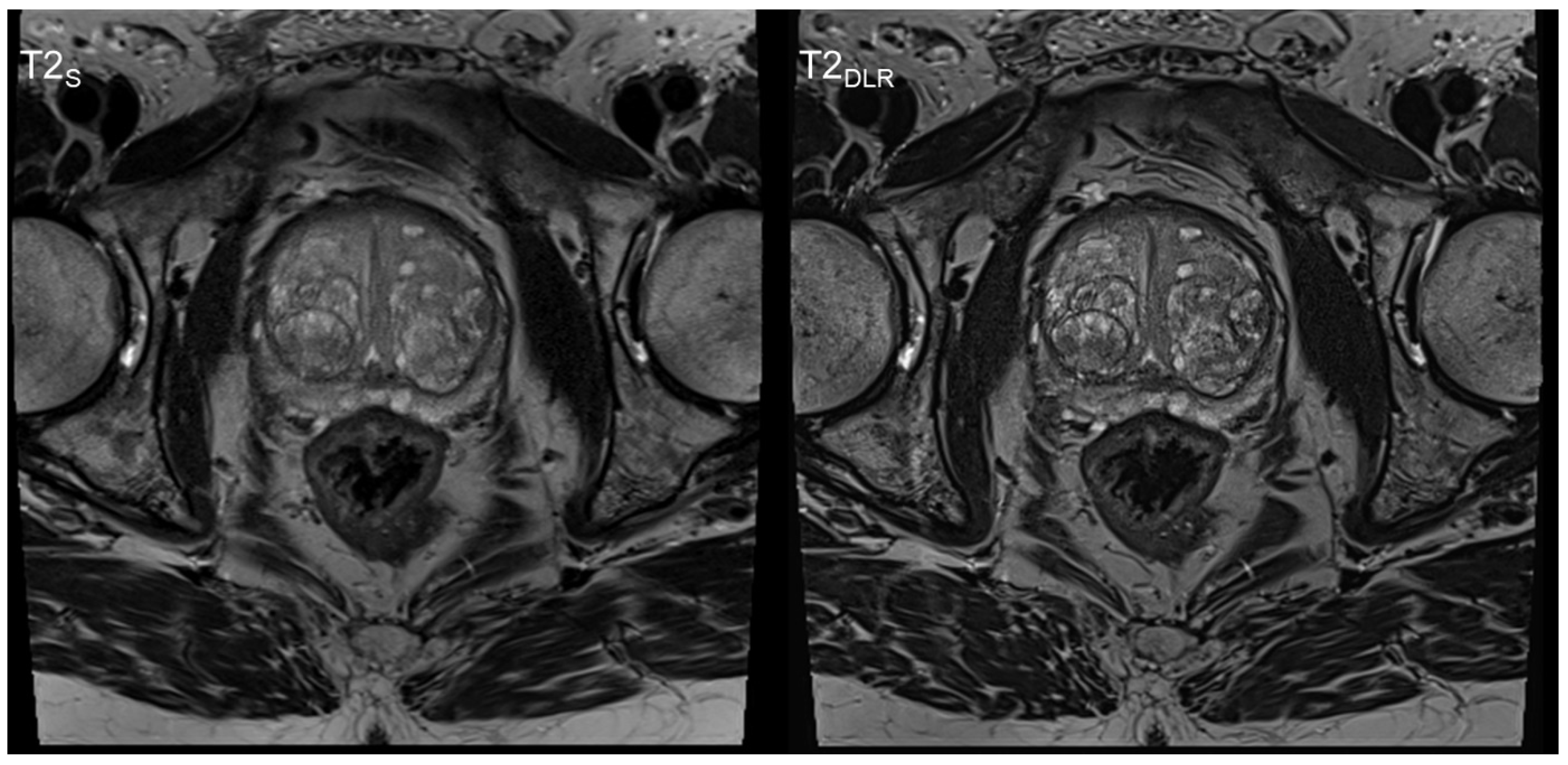 Cancers 15 00578 g001 Cancers 15 00578 g001