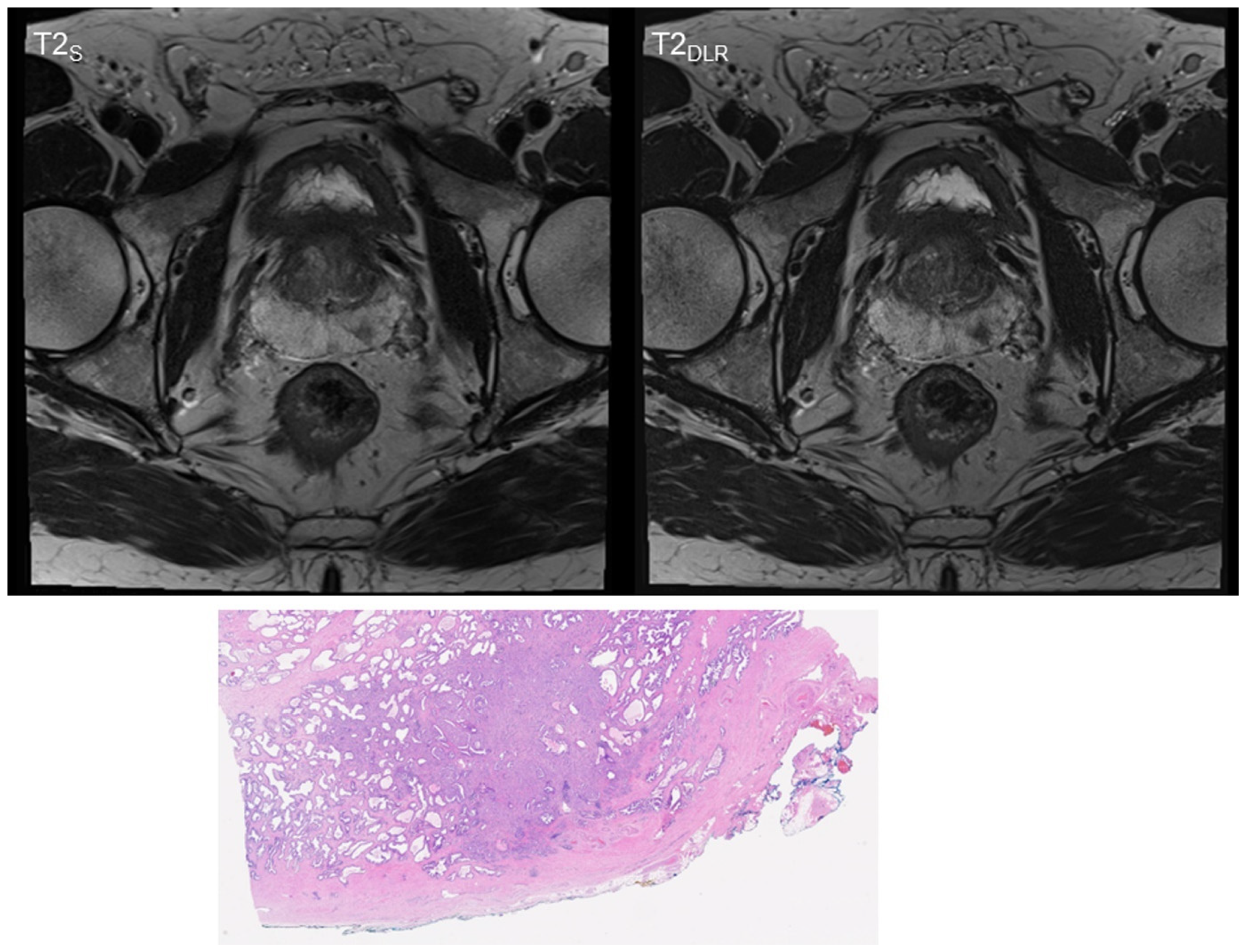 Cancers 15 00578 g002 Cancers 15 00578 g002