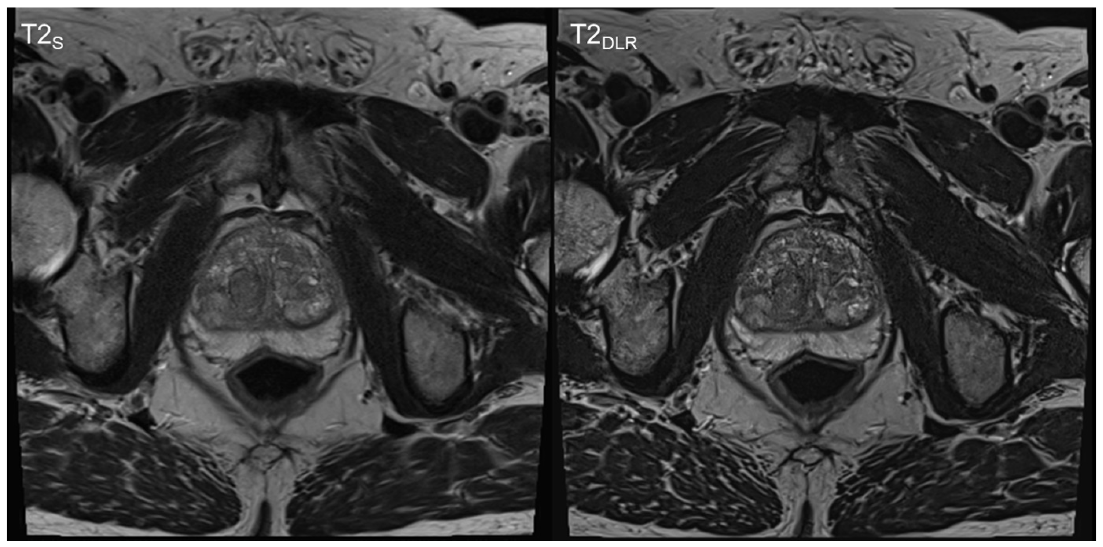 Cancers 15 00578 g003 Cancers 15 00578 g003