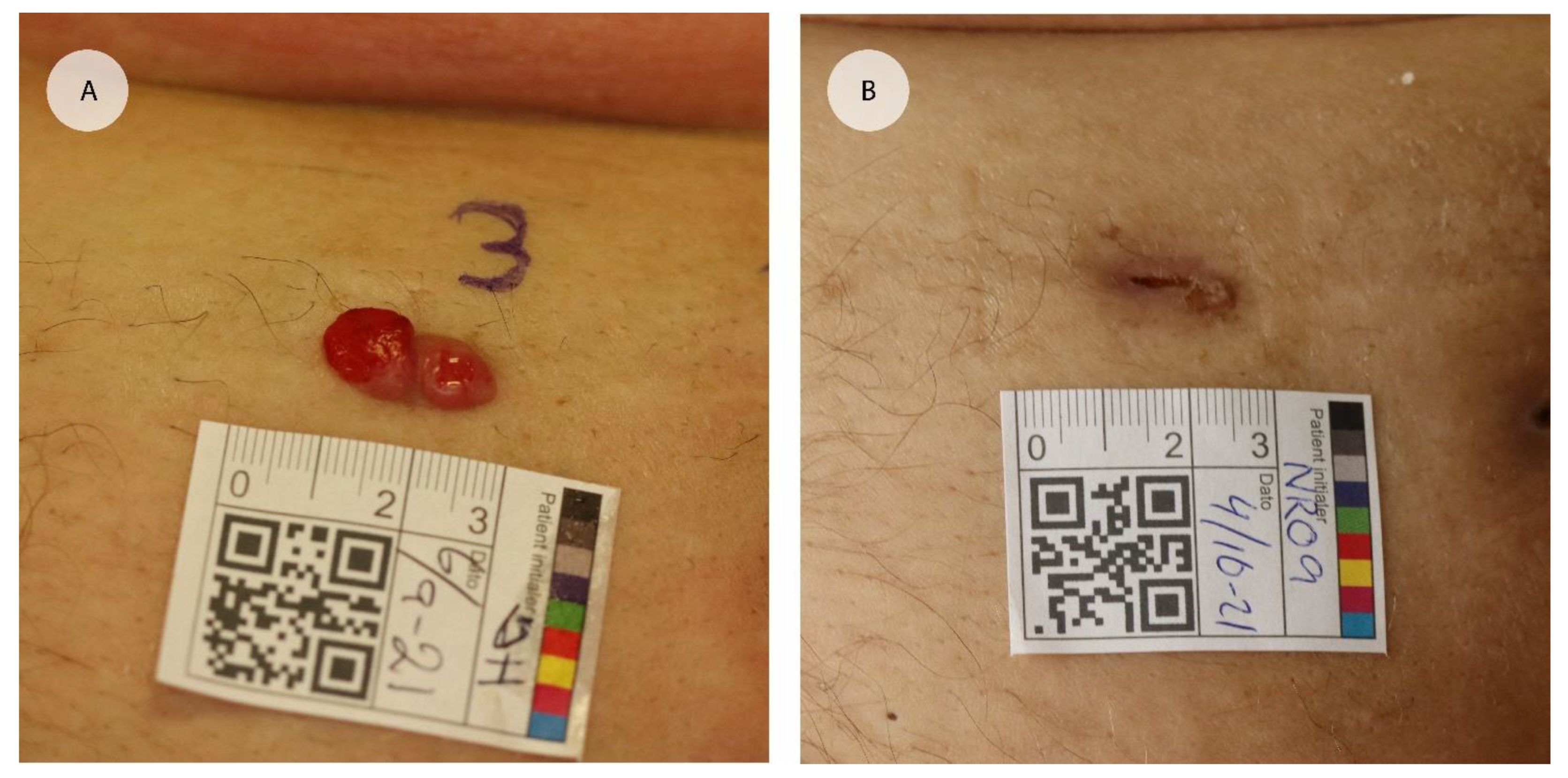 Cancers 15 00599 g002 Cancers 15 00599 g002