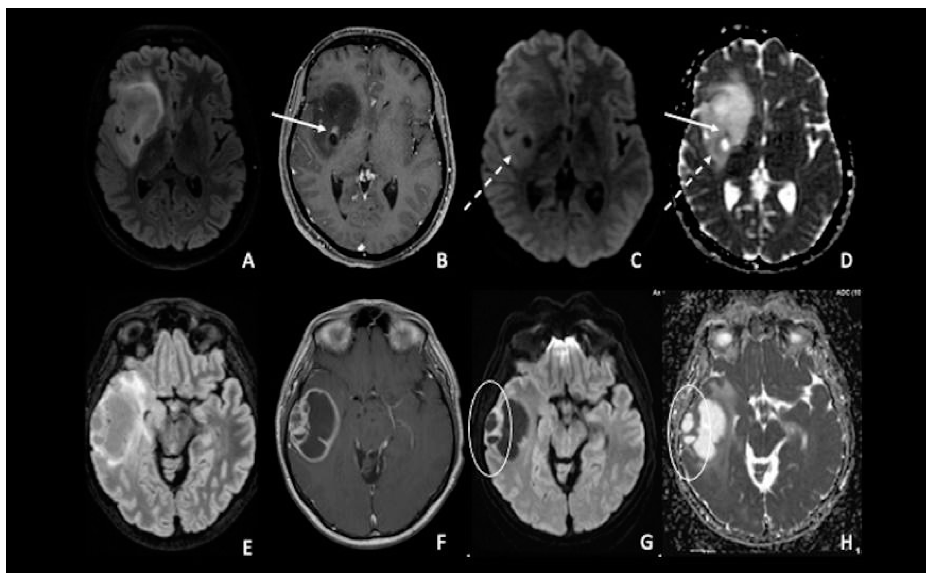 Cancers 15 00618 g002