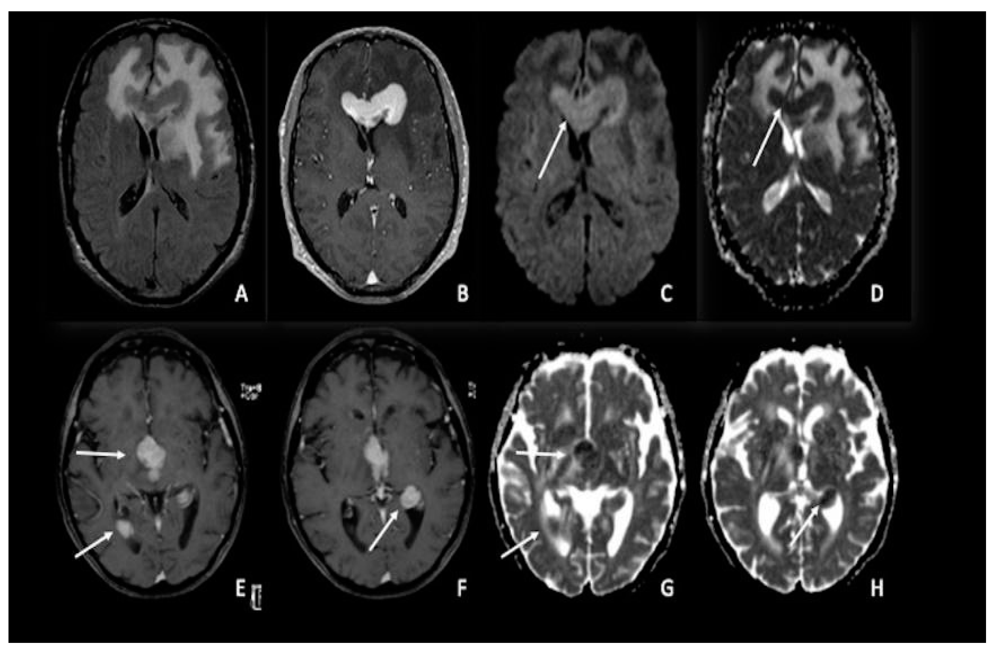 Cancers 15 00618 g003