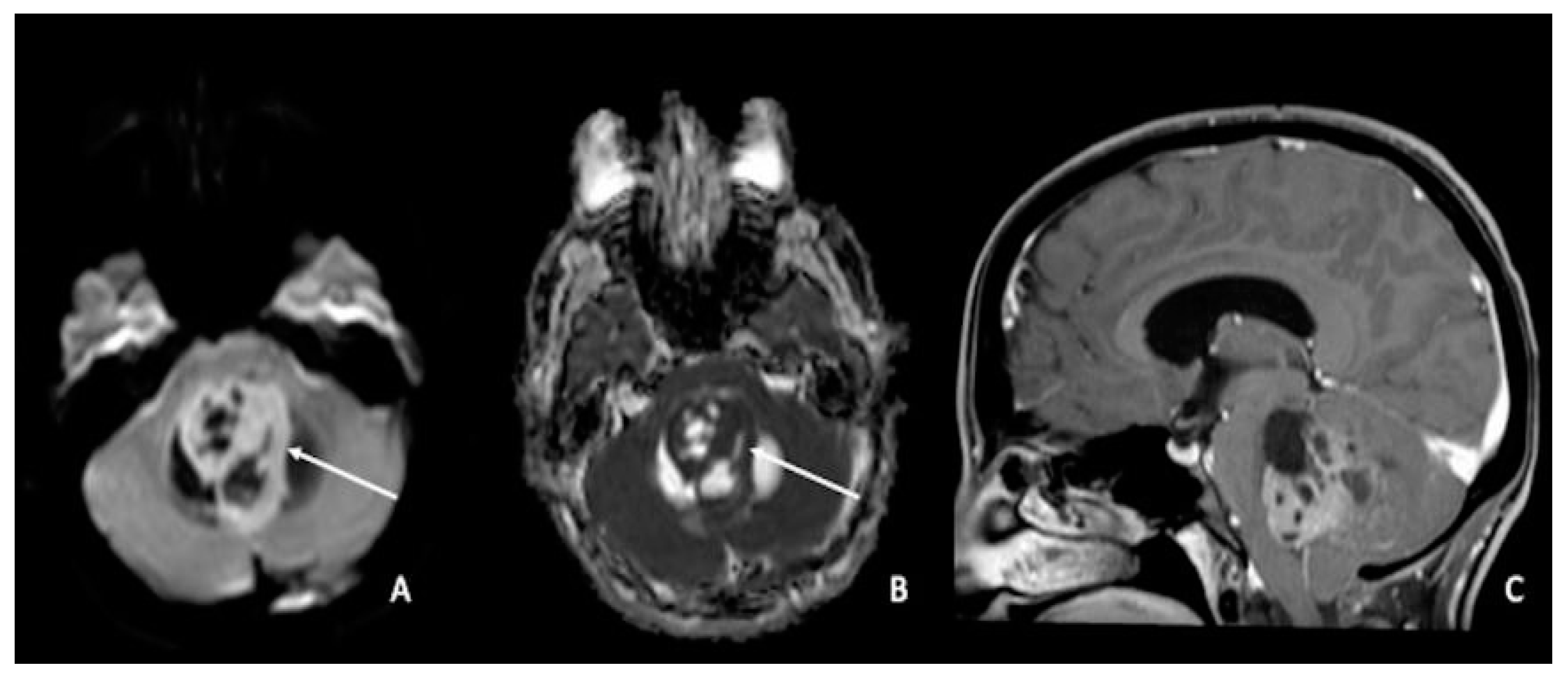 Cancers 15 00618 g004