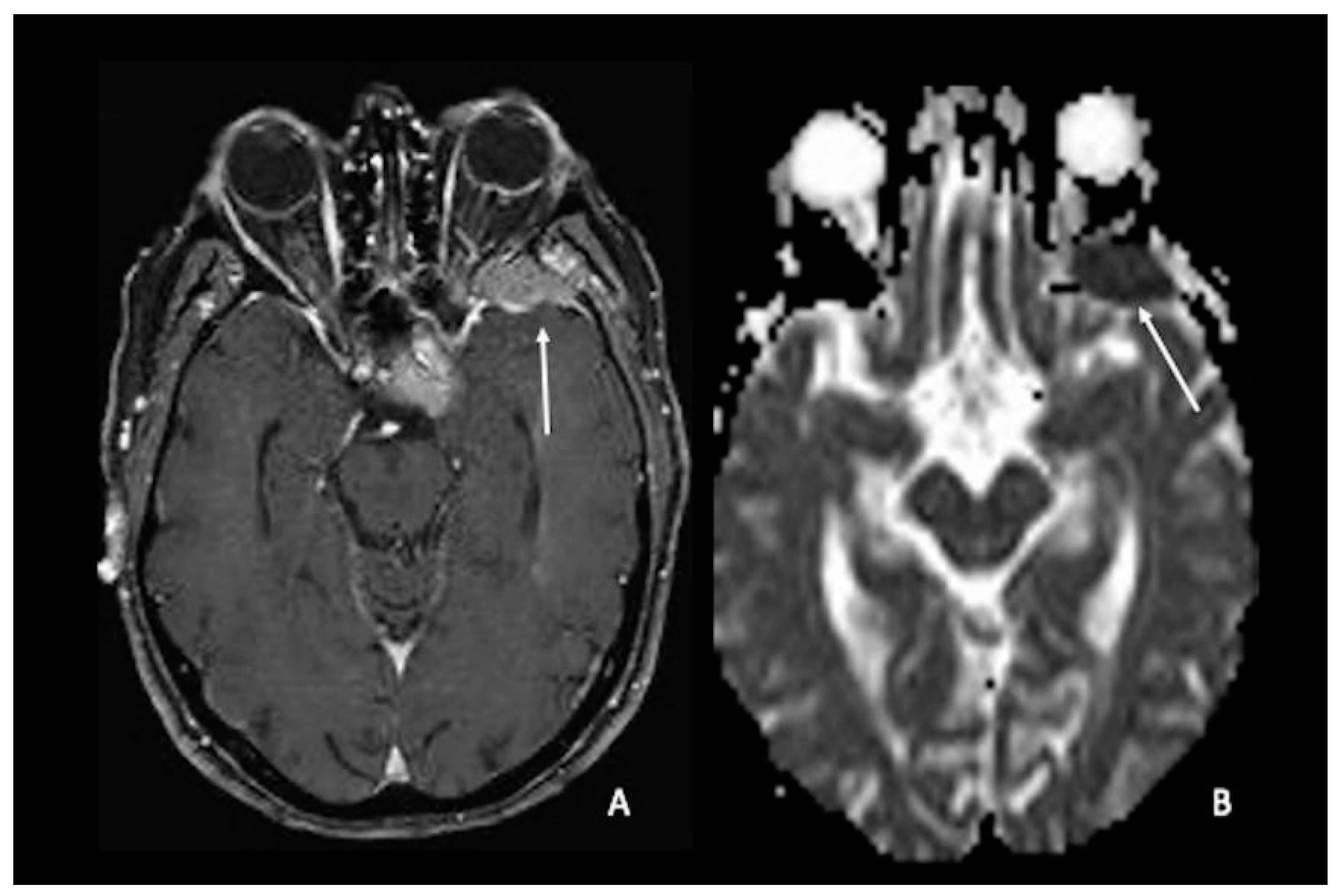 Cancers 15 00618 g005