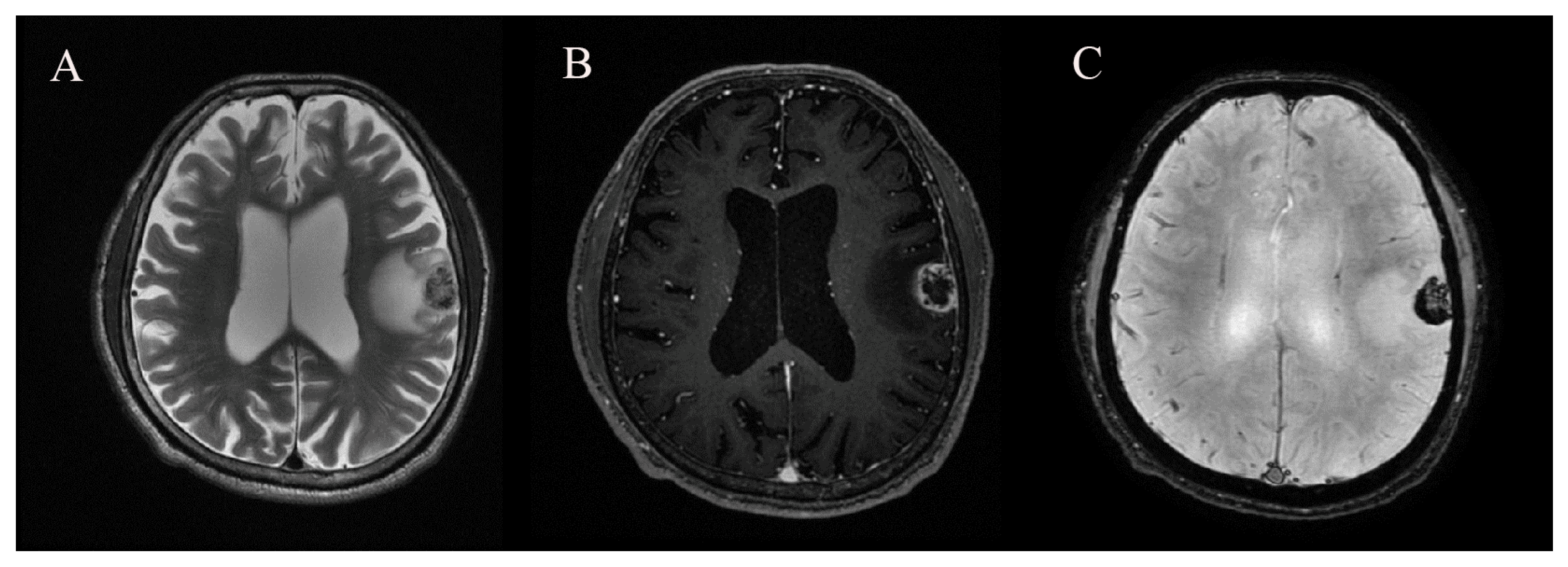 Cancers 15 00619 g002 Cancers 15 00619 g002