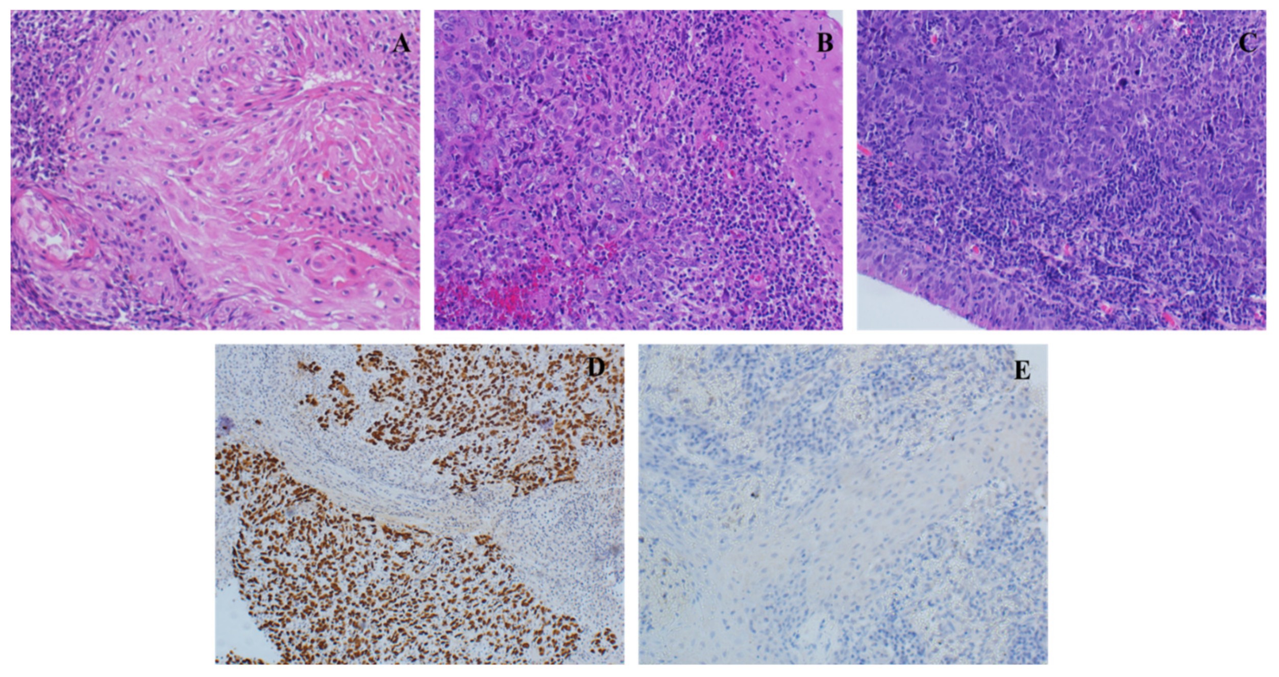 Cancers 15 00643 g001