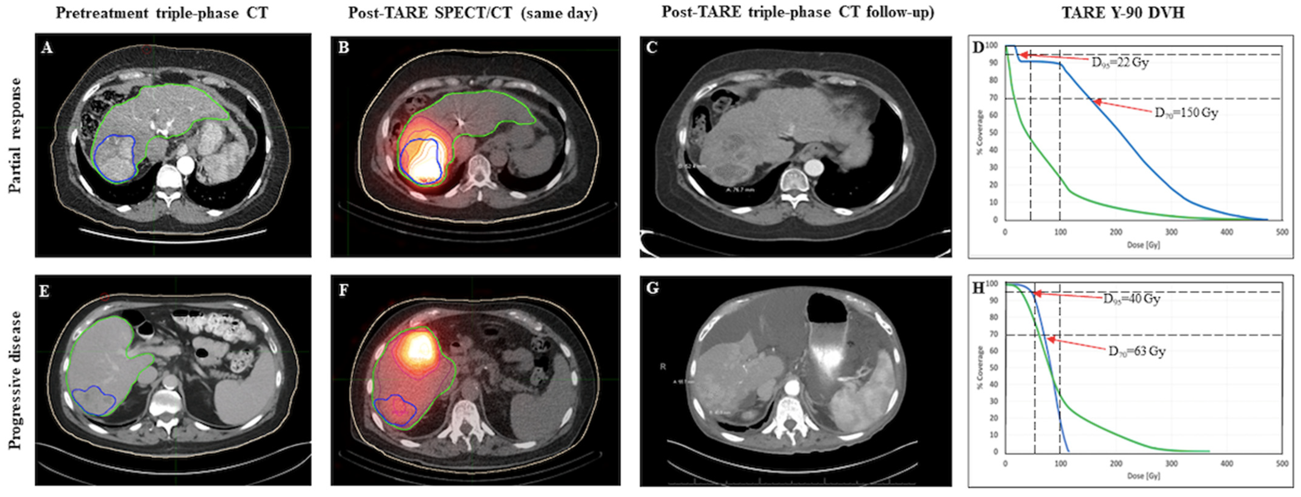 Cancers 15 00645 g002 Cancers 15 00645 g002