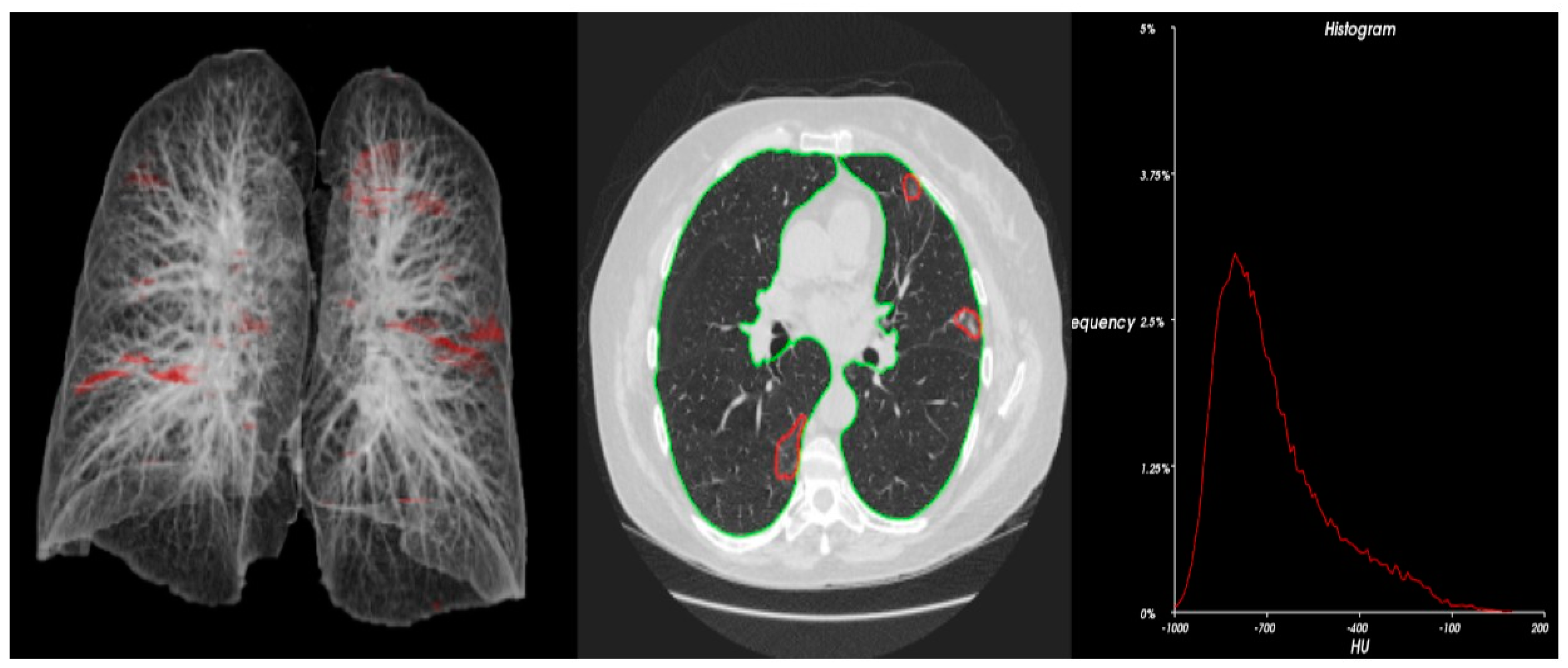 Cancers 15 00651 g001 Cancers 15 00651 g001